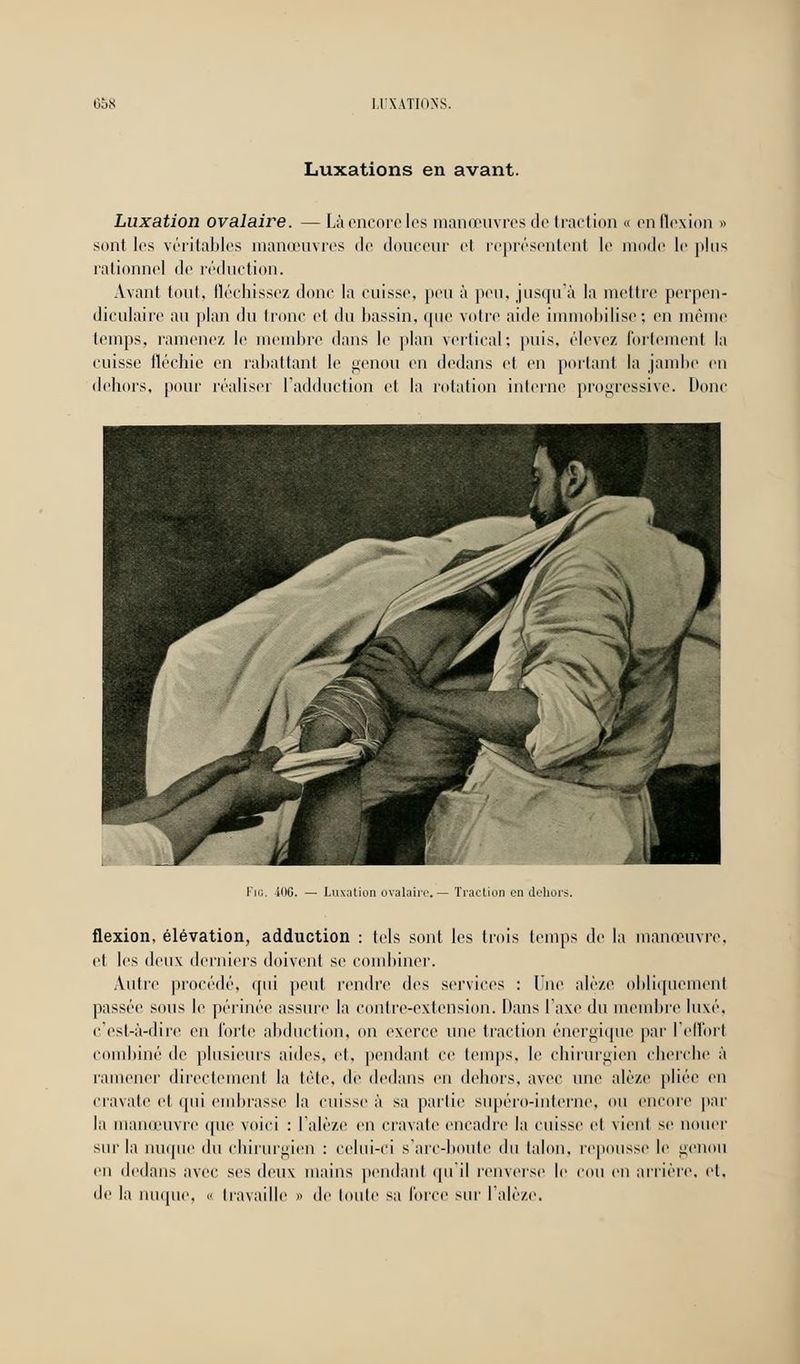 Luxations en avant. Luxation ovalaire. — Là encore les manœuvres île traction « en flexion » sont les véritables manœuvres de douceur cl représentent le mode le plus rationnel de réduction. Avant tout, fléchissez donc la cuisse, peu à peu, jusqu à la mettre perpen- diculaire au plan du tronc et du bassin, que voire aide immobilise; en même temps, ramené/, le membre dans le plan vertical: puis, élevez fortement la cuisse fléchie en rabattant le genou en dedans et en portant la jambe en dehors, pour réaliser l'adduction et la rotation interne progressive. Donc i(IG. Luxation ovalaire.— Traction en dehors. flexion, élévation, adduction : tels sont les trois temps de la manœuvre, et les deux derniers doivent se combiner. Autre procédé, qui peut rendre des services : Une alé/.e obliquement passée sous le périnée assure la contre-extension. Dans l'axe du membre luxé. c'est-à-dire en forte abduction, on exerce une traction énergique par l'effort combiné de plusieurs aides, et, pendant ce temps, le chirurgien cherche à ramener directement la tête, de dedans eu dehors, avec une alè/.e pliée en cravate et qui embrasse la cuisse à sa partie supéro-interne, ou encore par la manœuvre que voici : L'alèze en cravate encadre la cuisse et vient se nouer sur la nuque du chirurgien : celui-ci s'arc-boute du talon, repousse le genou en dedans avec ses deux mains pendant qu'il renverse le cou en arrière, et, de la nuque, <• travaille » de toute sa Force sur l'alèze.