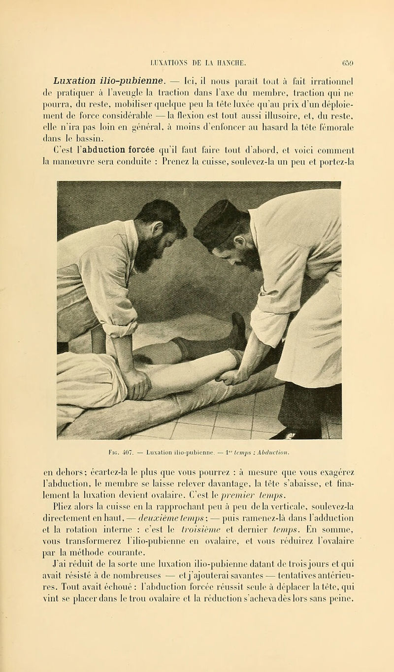 Luxation ilio-pubienne. — [ci, il nous paraît tout à fait irrationnel do pratiquer à l'aveugle la traction dans l'axe du membre, traction qui ne pourra, du reste, mobiliser quelque peu la tête luxée qu'au prix d'un déploie- ment de force considérable — la flexion est tout aussi illusoire, et, du reste, elle n'ira pas loin en général, à moins d'enfoncer au hasard la tète fémorale dans le bassin. C'est l'abduction forcée qu'il faut faire tout d'abord, et voici comment la manœuvre sera conduite : Prenez la cuisse, soulevez-la un peu et portez-la Fig. -107. — Luxation ilio-pubienne. — liemj}S : Abduction. en debors; écartez-la le plus que vous pourrez : à mesure que vous exagérez l'abduction, le membre se laisse relever davantage, la tète s'abaisse, et fina- lement la luxation devient ovalaire. C'est le premier temps. Pliez alors la cuisse en la rapprochant peu à peu delà verticale, soulevez-la directement en haut, — deuxième temps ; — puis ramenez-là dans l'adduction et la rotation interne : c'est le troisième et dernier temps. En somme, vous transformerez l'ilio-pubienne eu ovalaire, et vous réduirez l'ovalaire par la méthode courante. J'ai réduit de la sorte une luxation ilio-pubienne datant de trois jours et qui avait résisté à de nombreuses — et j'ajouterai savantes — tentatives antérieu- res. Tout avait échoué : l'abduction forcée réussit seule à déplacer la tête, qui vint se placer dans le trou ovalaire et la réduction s'acheva dès lors sans peine.