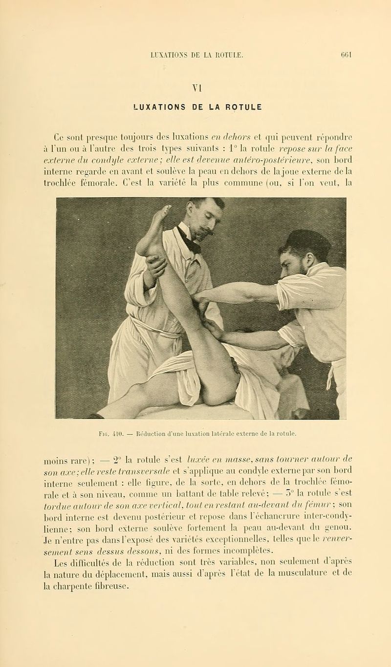 VI LUXATIONS DE LA ROTULE Ce sont presque toujours des luxations en dehors et qui peuvent répondre à l'un on à l'autre des trois types suivants : 1° la rotule repose sur la face externe du condyle externe; elle est devenue anle'ro-postérieure. son bord interne regarde en avant et soulève la peau en dehors de la joue externe delà trochlée fémorale. C'est la variété la plus commune (ou. si l'on veut, la Fig. no. Réduction d'une luxation latérale externe de la rotule. moins rare | : —- la rotule s'est luxée en masse, sans tourner autour de son axe; elle reste transversale et s'applique au condyle externe par son bord interne seulement : elle ligure, de la sorte, en dehors de la trochlée fémo- rale et à son niveau, comme un battant de table relevé: — 5° la rotule s est tordue autour de son axe vertical, tout en restant au-devant du fémur; son bord interne est devenu postérieur et repose dans l'échancrure inter-eondy- lienne; son bord externe soulève fortement la peau au-devant du genou. Je n'entre pas dans l'exposé des variétés exceptionnelles, telles que le renvei*- sement sens dessus dessous, ni des formes incomplètes. Les difficultés de la réduction sont très variables, non seulement d après la nature du déplacement, mais aussi d'après l'état de la musculature et de- là charpente fibreuse.
