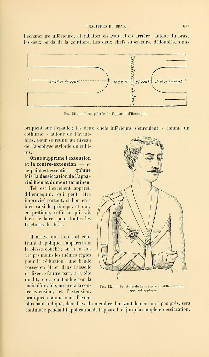 l'échancrure inférieure, et rabattez en avant et en arrière, autour du bras, les deux bords de la gouttière. Les deux chefs supérieurs, dédoublés, s'im- i Ci il de iS a 3o cent de 22 a \h~27 cent'A !» s Fie. 421. — Pièce plâtrée de l'appareil d'Hennequin. delô a 2a cent. ' briquent sur l'épaule ; les deux chefs inférieurs s'enroulent « comme un cothurne » autour de l'avant- bras, pour se réunir au niveau de l'apophyse styloïde du cubi- tus. On ne supprime l'extension et la contre-extension — et ce point est essentiel — qu'une fois la dessiccation de l'appa- riel bien et dûment terminée. Tel est l'excellent appareil d'Hennequin, qui peut être improvisé partout, si l'on en a bien saisi le principe, et qui, en pratique, suffit à qui sait bien le faire, pour toutes les fractures du bras. Il arrive que l'on soit con- traint d'appliquer l'appareil sur le blessé couché ; on n'en sui- vra pas moins les mêmes règles pour la réduction : une bande passée en étrier dans l'aisselle et fixée, d'autre part, à la tête du lit, etc., ou tendue par la main d'un aide, assurera la con- tre-extension, et l'extension, pratiquée comme nous l'avons plus haut indiqué, dans l'axe du membre, horizontalement ou à peu près, sera continuée pendant l'application de l'appareil, et jusqu'à complète dessiccation. Fie. 422. Fracture du bras (appareil d'Hennequin). L'appareil appliqué.