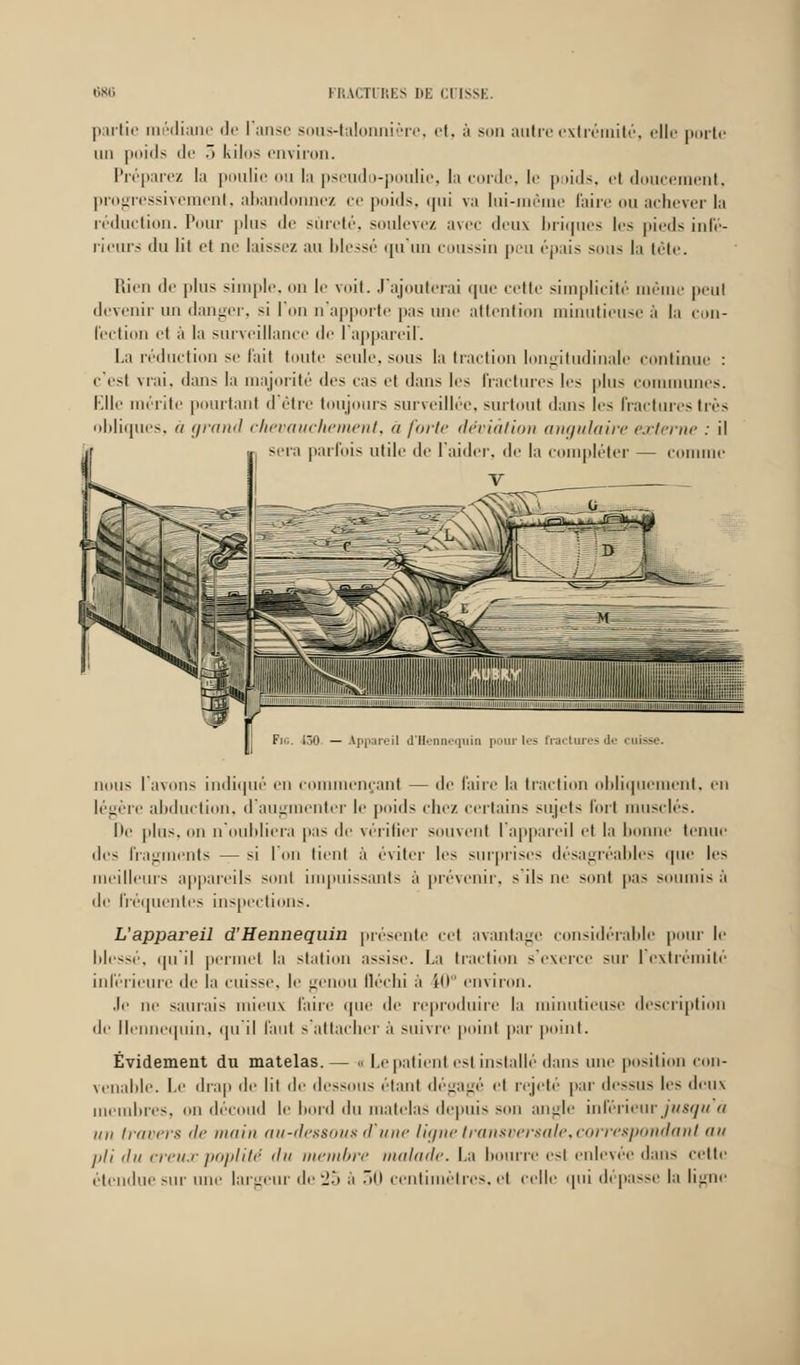 partie médiane de I anse sous-talonnière, et, à son autre extrémité, elle porte un poids de •> kilos emiron. Préparez la poulie ou la pseudo-poulie, la corde, le p lids, et doucement, progressivement, abandonnez ce poids, qui va lui-même faire ou achever la réduction. Pour plus de sûreté, soulevez avec deux briques les pieds infé- rieurs du lit et ne laissez au blessé qu'un coussin peu épais sous l;i tête. Rien de plus simple, on le voit. J'ajouterai que cette simplicité même peul devenir un danger, si I un n apporte pas une attention minutieuse à la con- fection et à la surveillance de l'appareil'. La réduction se fait toute seule, sous la traction longitudinale continue : c'esl vrai, dans la majorité des cas el dans les fractures les plus communes. Elle mérite pourtant d'être toujours surveillée, surtout dans les fractures très obliques, à grand chevauchement, a forte déviation angulaire externe : il sera parfois utile de l'aider, de la compléter — comme Fie. i30. — Appareil d'Henneçniin pour les fracturesde cuisse. nous l'avons indiqué en commençant — de faire la traction obliquement, en légère abduction, d'augmenter le poids chez certains sujets fort musclés. Ile plus, on n oubliera pas de vérifier souvent l'appareil et la lionne tenue des fragments — si l'on tient à éviter les surprises désagréables que les meilleurs appareils sonl impuissants à prévenir, s'ils ne sont pas soumis à île fréquentes inspections. L'appareil d'Hennequin présente ce1 avantage considérable pour le blessé, qu'il permet la station assise. La traction s'exerce sur l'extrémité inférieure de la cuisse, le genou fléchi à Î0° environ. Je ne saluais mieux l'aire que de reproduire la minutieuse description de llennequin, qu'il Faut s'attacher à suivre point par point. Évidement du matelas.— a Le patient est installé dans une position con- venable. Le drap de lit de dessous étant dégagé et rejeté par dessus les deux membres, on découd le bord d atelas depuis son angle inférieur jusqu <i un travers de main au-dessous d'une ligne transversale,correspondant au pli du creuxpoplité <lu membre malade. La bourre est enlevée dans cette étendue sur une largeur «le 25 à 30 centimètres, et celle qui dépasse la ligne