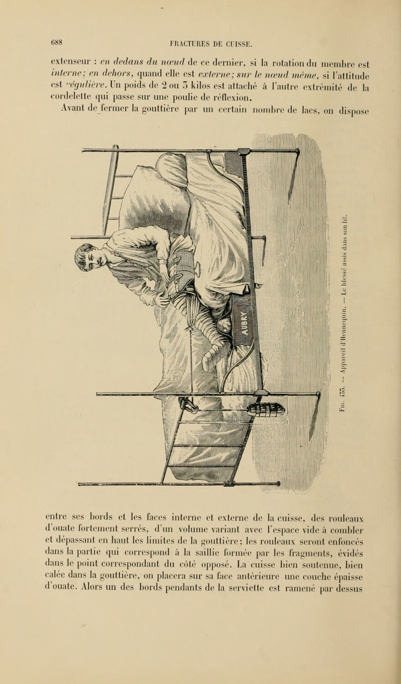 extenseur : en dedans du nœud de ce dernier, si la rotation du membre est interne; en dehors, quand elle est externe; sur le nœud même, si l'attitude est égulière. On poids de '2 ou 3 kilos est attaché à l'autre extrémité de la cordelette qui passe sur une poulie de réflexion. Avant de fermer la gouttière par un certaii lire de lacs, on dispose entre ses bords et les faces interne et externe de la cuisse, des rouleaux d'ouate fortement serrés, d'un volume variant avec l'espace vide à combler et dépassant en haut les limites de la gouttière; les rouleaux seront enfoncés dans la partie qui correspond à la saillie formée par les fragments, évidés dans le point correspondant du côté opposé. La cuisse bien soutenue, bien calée dans la gouttière, on placera sur sa face antérieure une couche épaisse d'ouate. Alors un des bords pendants de la serviette esi ramené pardessus