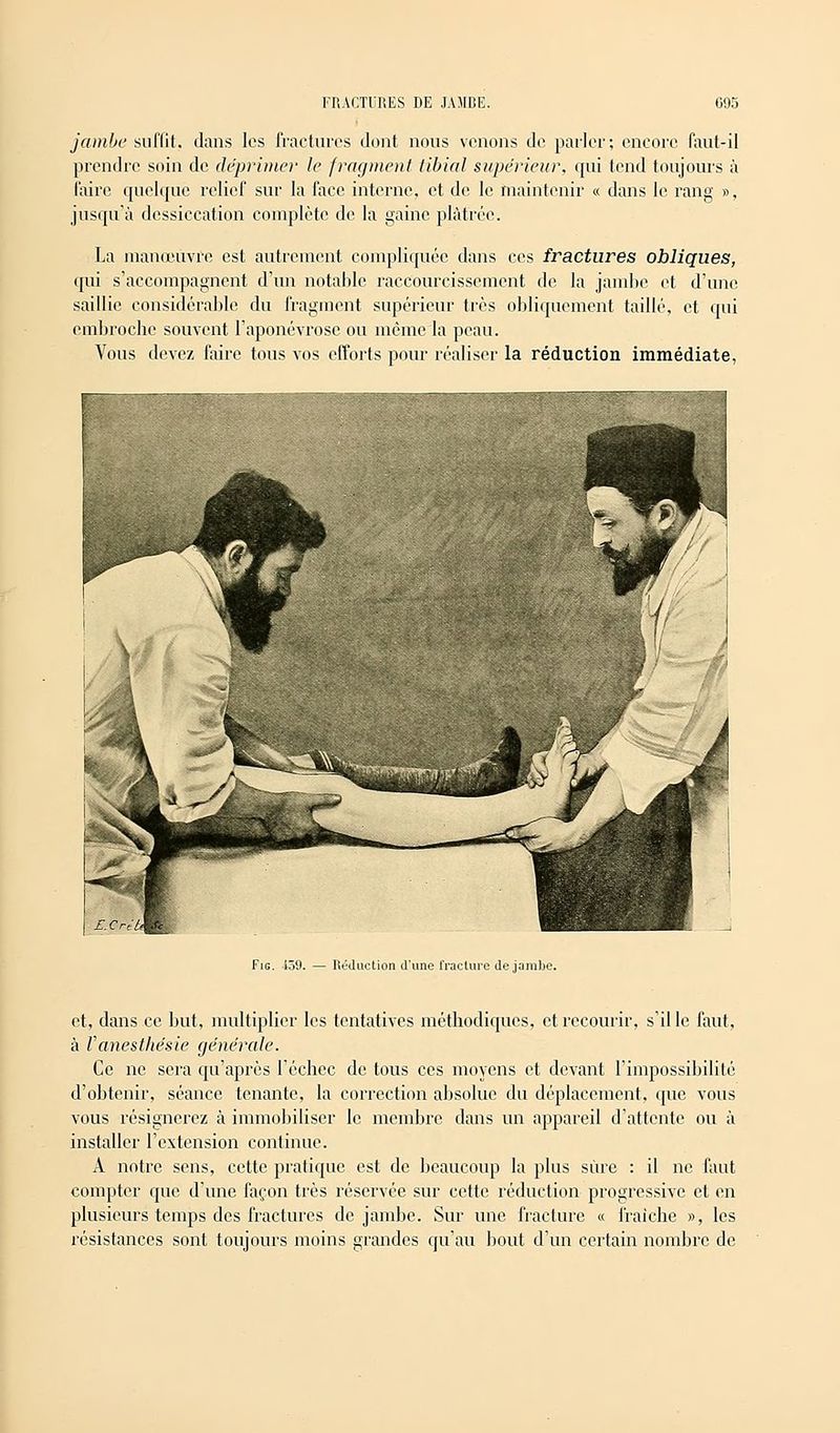 jambe suffit, dans les fractures dont nous venons de parler; encore faut-il prendre soin de déprimer le fragment libial supérieur, qui tend toujours à faire quelque relief sur la face interne, et de le maintenir « dans le rang », jusqu'à dessiccation complète de la gaine plâtrée. La manœuvre est autrement compliquée dans ces fractures obliques, qui s'accompagnent d'un notable raccourcissement de la jambe et d'une saillie considérable du fragment supérieur très obliquement taillé, et qui embroche souvent l'aponévrose ou môme la peau. Vous devez faire tous vos efforts pour réaliser la réduction immédiate, Fie. 159. — Réduction d'une fracture de jambe. et, dans ce but, multiplier les tentatives méthodiques, et recourir, s'il le faut, à Vanesthésie générale. Ce ne sera qu'après l'échec de tous ces moyens et devant l'impossibilité d'obtenir, séance tenante, la correction absolue du déplacement, que vous vous résignerez à immobiliser le membre dans un appareil d'attente ou à installer l'extension continue. A notre sens, cette pratique est de beaucoup la plus sûre : il ne faut compter que d'une façon très réservée sur cette réduction progressive et en plusieurs temps des fractures de jambe. Sur une fracture « fraîche », les résistances sont toujours moins grandes qu'au bout d'un certain nombre de