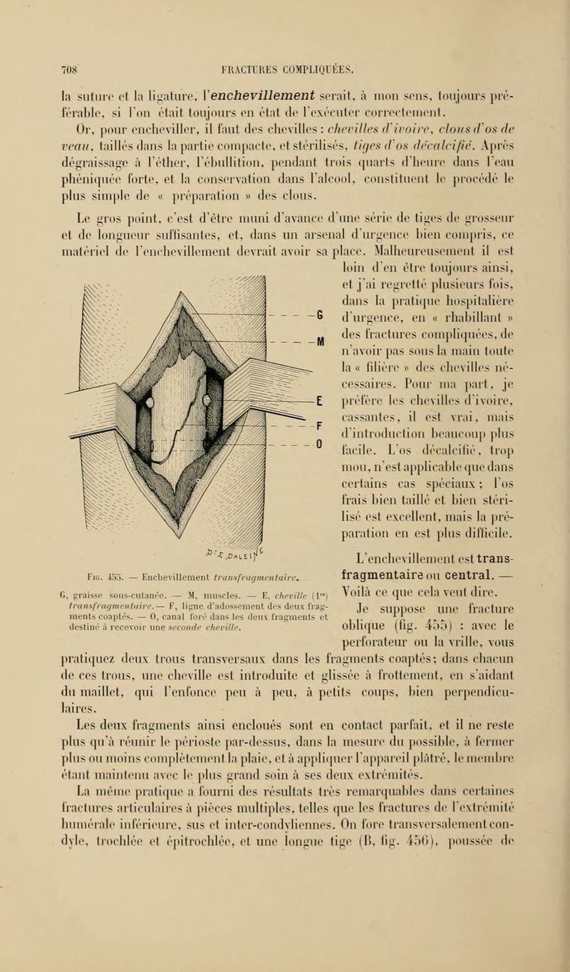 la suture ei la ligature, Yenchevillement serait, à mon sens, toujours pré- férable, si l'on était toujours en état de l'exécuter correctement. Or, pour encheviller, il faul des chevilles : chevilles il ivoire, clousd*os de veau, taillés dans la partie compacte, et stérilisés, tiges d'os décalcifié. Après dégraissage à l'éther, l'ébullition, pendant trois quarts d'heure dans l'eau phéniquée forte, et la conservation dans l'alcool, constituent le procède le plus simple de « préparation » des clous. Le gros point, c'est d'être muni d'avance d'une série de tiges de grosseur et de longueur suffisantes, et, dans un arsenal d'urgence bien compris, ce matériel de Penehevillement devrait avoir sa place. Malheureusement il est loin d'en être toujours ainsi, et j'ai regretté plusieurs fois, dans la pratique hospitalière d'urgence, en « rhabillant » des fractures compliquées, de n'avoir pas sous la main toute la « filière » des chevilles né- cessaires. Pour ma part, je préfère les chevilles d'ivoire, cassantes, il est vrai, mais d'introduction beaucoup plus facile. L'os décalcifié, trop mou. n'est applicable que dans certains cas spéciaux; l'os frais bien taillé et bien stéri- lisé est excellent, mais la pré- paration en est plus difficile. Fie. 453. *'*J>ai.siJ Enchevillement transfragmentaii G, graisse sous-cutanée. — M, muscles. — E. cheville 1 transfragmentaire.— F, ligne d'adossement des deux frag- ments coaptés. — 0, canal foré dans les deux fragments et destiné à recevoir nue seconde cheville. L'enchevillemenl est traus fragmentaire ou central. — Voilà ce que cela veut dire. Je suppose une fracture oblique (fig. 155) : avec le perforateur ou la vrille, vous pratiquez deux trous transversaux dans les fragments coaptés; dans chacun de ces trous, une cheville est introduite et glissée à frottement, en s'aidant du maillet, qui l'enfonce peu à peu, à petits coups, bien perpendicu- laires. Les deux fragments ainsi encloués sont en contact parlait, et il ne reste plus qu'à réunir le périoste par-dessus, dans la mesure du possible, à fermer plus ou moins complètement la plaie, et à appliquer l'appareil plâtré, le membre étant maintenu avec le plus grand soin à ses deux extrémités. La même pratique a fourni des résultats très remarquables dans certaines fractures articulaires à pièces multiples, telles que les fractures de l'extrémité humérale inférieure, sus et inter-condyliennes. On fore transversalementcon- dyle, trochlée et épitrochlée, et une longue tige (B, fig. i56), poussée de