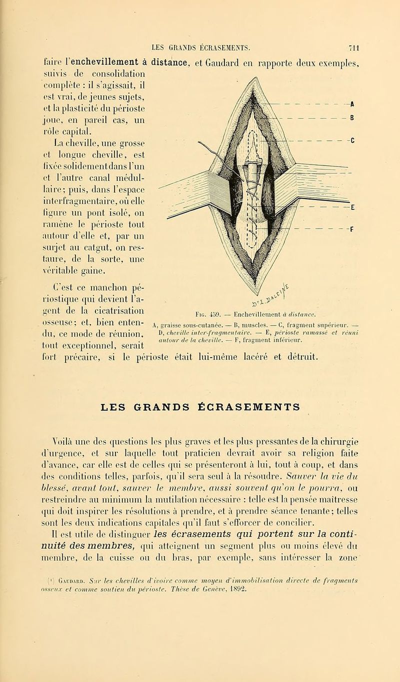 faire l'enchevillement à distance, et Gaudard en rapporte deux exempl suivis de consolidation complète : il s'agissait, il est vrai, de jeunes sujets, et la plasticité du périoste joue, en pareil cas, un rôle capital. La cheville, une grosse et longue cheville, est lixée solidement dans l'un et l'autre canal médul- es, faire ; puis, dans l'espace interfragmentaire, où elle ligure un pont isolé, on ramène le périoste tout autour d'elle et, par un surjet au catgut, on res- taure, de la sorte, une véritable gaine. C'est ce manchon pé- riostique qui devient l'a- gent de la cicatrisation osseuse: et, bien enten- du, ce mode de réunion, tout exceptionnel, serait fort précaire, si le périoste était lui-même lacéré et détruit Fig. 459. Fnchevillement à distance. A, graisse sous-cutanée. — B, muscles. — C, fragment supérieur. D, cheville inter-fragmentaire. — E, périoste ramassé et réi- autour de la cheville. — F, fragment inférieur. LES GRANDS ÉCRASEMENTS Voilà une des questions les plus graves et les plus pressantes de la chirurgie d'urgence, et sur laquelle tout praticien devrait avoir sa religion faite d'avance, car elle est de celles qui se présenteront à lui, tout à coup, et dans des conditions telles, parfois, qu'il sera seul à la résoudre. Sauver la vie du blesse', avant fout, sauver le membre, aussi souvent qu'on le pourra, ou restreindre au minimum la mutilation nécessaire : telle est la pensée maîtresse qui doit inspirer les résolutions à prendre, et à prendre séance tenante; telles sont les deux indications capitales qu'il faut s'efforcer de concilier. Il est utile de distinguer les écrasements qui portent sur la conti- nuité des membres, qui atteignent un segment plus ou moins élevé du membre, de la cuisse ou du bras, par exemple, sans intéresser la zone ['' G\cdard. Sur les chevilles d'ivoire comme moyen d'immobilisation directe de fragments osseux et comme soutien dit périoste. Thèse de Genève, 1892.
