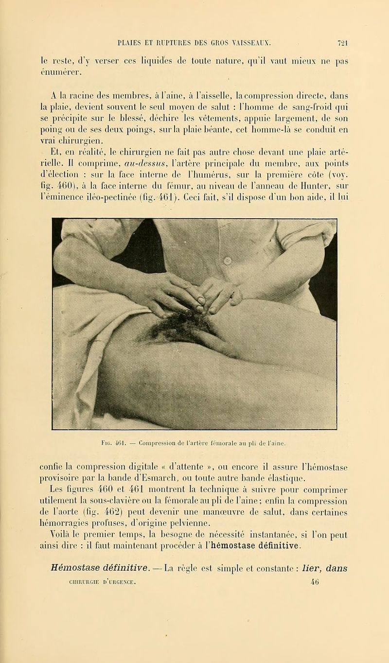 le reste, d'y verser ces liquides de toute nature, qu'il vaut mieux ne pas cnumérer. A la racine des membres, à l'aine, à l'aisselle, la compression directe, dans la plaie, devient souvent le seul moyen de salut : l'homme de sang-froid qui se précipite sur le blessé, déchire les vêtements, appuie largement, de son poing ou de ses deux poings, sur la plaie béante, cet homme-là se conduit en vrai chirurgien. Et, en réalité, le chirurgien ne fait pas autre chose devant une plaie arté- rielle. Il comprime, au-dessus, l'artère principale du membre, aux points d'élection : sur la face interne de l'humérus, sur la première côte (voy. fig. 460), à la face interne du fémur, au niveau de l'anneau de Hunter, sur l'éminence iléo-pectinée (fig. 461). Ceci fait, s'il dispose d'un bon aide, il lui Fig. 461. — Compression de l'artère fémorale au pli de l'aine. confie la compression digitale « d'attente », ou encore il assure l'hémostase provisoire par la bande d'Esmarch, ou toute autre bande élastique. Les figures 460 et 461 montrent la technique à suivre pour comprimer utilement la sous-clavière ou la fémorale au pli de l'aine ; enfin la compression de l'aorte (fig. 462) peut devenir une manœuvre de salut, dans certaines hémorragies profuses, d'origine pelvienne. Voilà le premier temps, la besogne de nécessité instantanée, si l'on peut ainsi dire : il faut maintenant procéder à l'hémostase définitive. Hémostase définitive. — La règle est simple et constante : lier, dans chirurgie d'urgence. 46