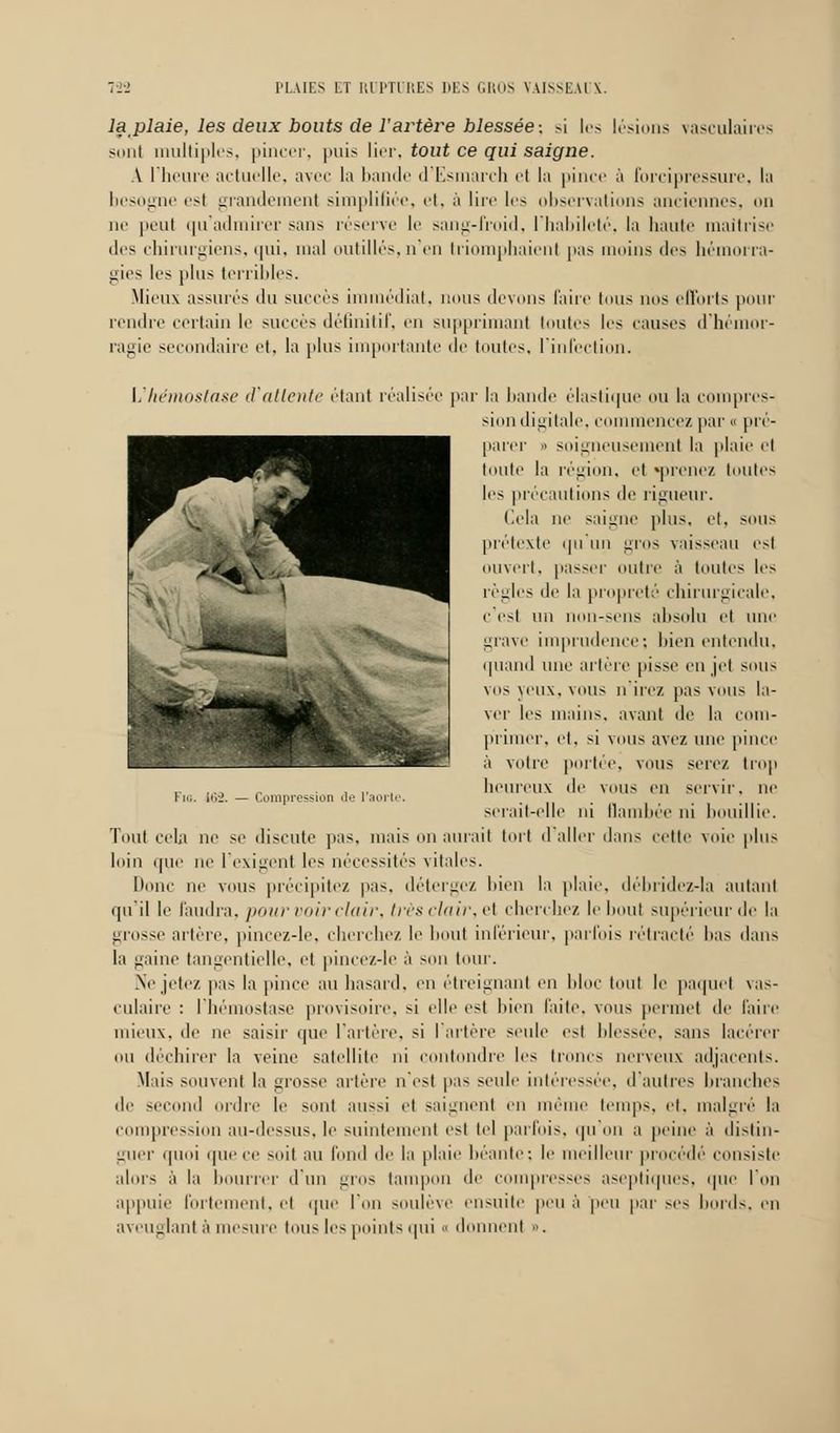 laplaie, les deux bouts de l'artère blessée-, si les lésions vasculaires sont multiples, pincer, puis lier, tout ce qui saigne. \ l'heure actuelle, avec la bande d'Esmarch et la pince à forcipressure, la besogne est grandement simplifiée, et, à lire les observations anciennes, on ne peut qu'admirer sans réserve le sang-froid, l'habileté, la liante maîtrise des chirurgiens, qui, mal outillés, n'en triomphaient pas moins des hémorra- gies les plus terribles. Mieux assurés du succès immédiat, nous devons faire tous nos efforts pour rendre certain le succès définitif, en supprimant toutes les causes d'hémor- ragie secondaire et, la plus importante de toutes, l'infection. L'hémostase d'attente étant réalisée par la bande élastique ou la compres- sion digitale, commencez par « pré- parer « soigneusement la plaie et toute la région, et «prenez toutes le> précautions de rigueur. Cela ne saigne plus, et, sous prétexte qu'un gros vaisseau est ouvert, passer outre à toutes le^ règles de la propreté chirurgicale, c'est un non-sens absolu et une grave imprudence; bien entendu. quand une artère pisse en jet sous vos yeux, vous n'irez pas vous la- ver les mains, avant de la com- primer, et, si vous avez une pince à votre portée, vous serez trop heureux de vous en servir, ne serait-elle ni flambée ni bouillie. Fio. 162. Compression de l'aorte Tout cela ne se discute pas, mais on aurait tort d'aller dans cette voie plus loin que ne l'exigent les nécessités vitales. Donc ne vous précipitez pas. détergez bien la plaie, débridez-la autant qu'il le faudra, pour voir clair, trèsclair,el cherchez le bout supérieur de la grosse artère, pincez-le, cherchez le bout inférieur, parfois rétracté bas dans la gaine tangentielle, et pincez-le à son tour. Ne jetez pas la pince au hasard, en étreignant en bloc tout le paquet vas- culaire : l'hémostase provisoire, si elle est bien faite, vous permet de faire mieux, de ne saisir que l'artère, si l'artère seule est blessée, sans lacérer ou déchirer la veine satellite ni contondre les troncs nerveux adjacents. Mais souvent la grosse artère n'est pas seule intéressée, d'autres branches de sec I ordre le sont aussi et saignent en même temps, et, malgré la compression au-dessus, le suintement est tel parfois, <|u on a peine ;'i distin- guer quoi que ce >oit au fond de la plaie béante; le meilleur procédé consiste alors à la bourrer d'un gros tampon de compresses aseptiques, que Ton appuie fortement, et que l'on soulève ensuite peu à peu par ses bords, en aveuglant à mesure tous les points qui •< donnent ».