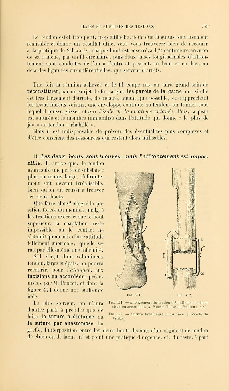Le tendon es(-il trop petit, trop effiloché, pour que la suture soit aisément réalisable et donne un résultat utile, vous vous trouverez bien de recourir à la pratique de Sehwartz: chaque bout est enserré,à 1/2 centimètre environ de sa tranche, par un fil circulaire; puis deux anses longitudinales d'affron- tement sont conduites de l'un à l'autre et passent, en haut et en bas, au delà des ligatures circonférentielles, qui servent d'arrêts. Une fois la réunion achevée et le fil coupé ras, on aura grand soin de reconstituer, par un surjet de fin catgut, les parois de la gaine, ou. si elle est très largement détruite, de refaire, autant que possible, en rapprochant les tissus fibreux voisins, une enveloppe continue au tendon, un tunnel sous lequel il puisse glisser et qui Visole de la cicatrice cutanée. Puis, la pean est suturée et le membre immobilisé dans l'attitude qui donne « le plus de jeu » au tendon « rhabillé ». Mais il est indispensable de prévoir des éventualités plus complexes et d'être conscient des ressources qui restent alors utilisables. B. Les deux bouts sont trouvés, mais l'affrontement est impos- sible. 11 arrive que, le tendon ayant subi une perte de substance plus ou moins large, l'affronte- ment soit devenu irréalisable, bien qu'on ait réussi à trouver les deux bouts. Que faire alors? Malgré la po- sition forcée du membre, malgré les tractions exercées sur le bout supérieur, la coaptation reste impossible, ou le contact ne s'établit qu'au prix d'une attitude tellement anormale, qu'elle se- rait par elle-même une infirmité. S'il s'agit d'un volumineux tendon, large et épais, on pourra recourir, pour l'allonger, aux incisions en accordéon, préco- nisées par M. Poucet, et dont la figure 471 donne une suffisante idée. Le plus souvent, on n'aura d'autre parti à prendre que de faire la suture à distance ou la suture par anastomose. La greffe, l'interposition entre les deux bouts distants d'un segment de tendon de chien ou de lapin, n'est point une pratique d'urgence, et, du reste, à part Fie. 471. Fie. 47-2. Fig. -171. —Allongement du tendon d'Achille par les inci- sions en accordéon. (A. Poncet, Thèse de Pécheux, cit.) Fil. llï. - Trnka.) Suture tendineuse à distance. (Procédé de