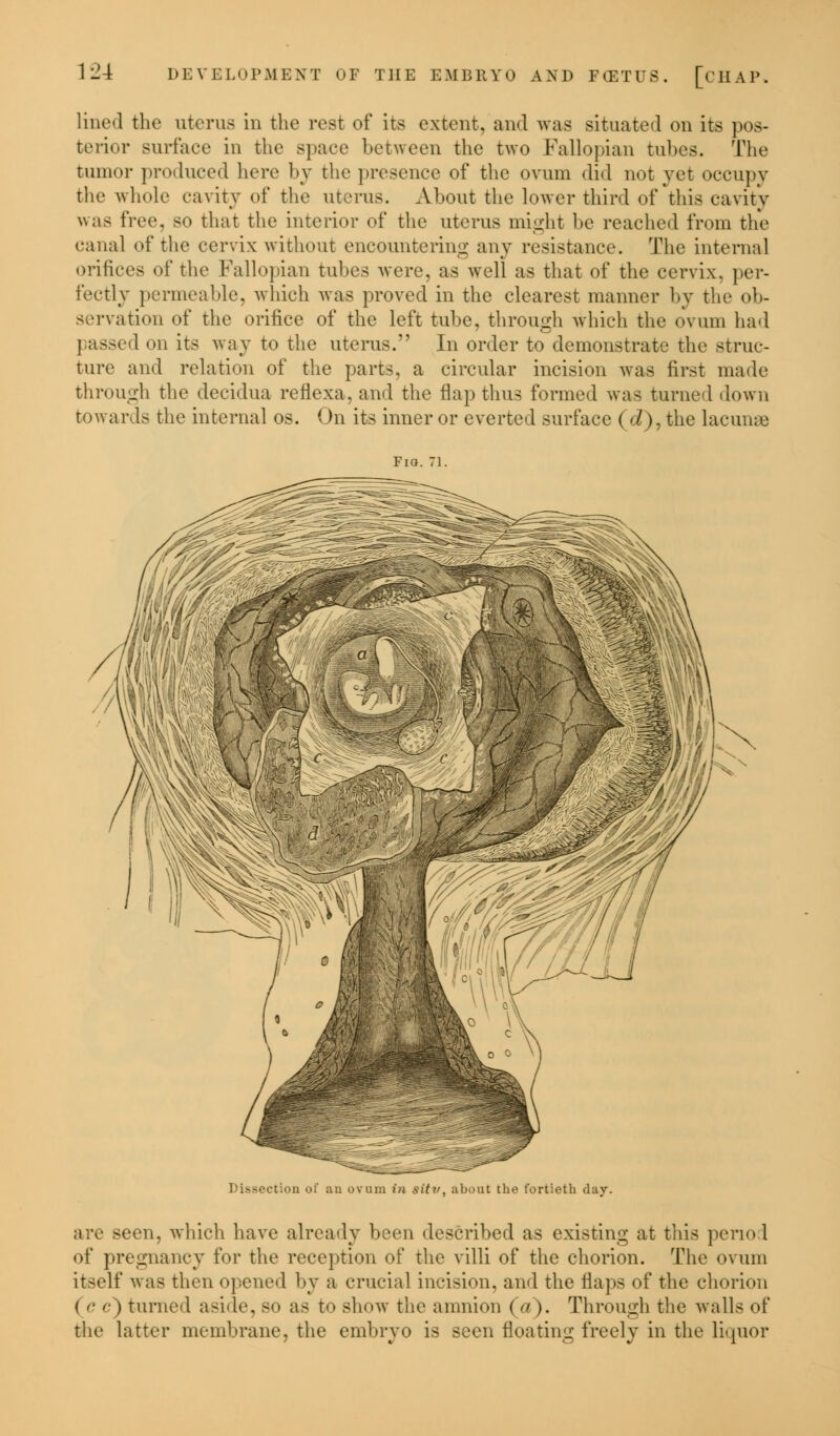 lined the uterus in the rest of its extent, and was situated on its pos- terior surface in the space between the two Fallopian tubes. The tumor produced here by the presence of the ovum did not jet occupy the whole cavity of the uterus. About the lower third of this cavity was tree, so that the interior of the uterus might be reached from the canal of the cervix without encountering any resistance. The internal orifices of the Fallopian tubes were, as well as that of the cervix, per- fectly permeable, which was proved in the clearest manner by the ob- servation of the orifice of the left tube, through which the ovum had passed on its way to the uterus. In order to demonstrate the struc- ture and relation of the parts, a circular incision was first made through the decidua reflexa, and the flap thus formed was turned down towards the internal os. On its inner or everted surface (d), the lacunae FiQ. 71. tion of an ovum in sitv, about the fortieth day. 3een, which have already been described as existing at this period of pregnancy for the reception of the villi of the chorion. The ovum itself was then opened by a crucial incision, and the flaps of the chorion ('•'•) turned aside, so as to show the amnion (a). Through the walls of the latter membrane, the embryo is seen floating freely in the liquor