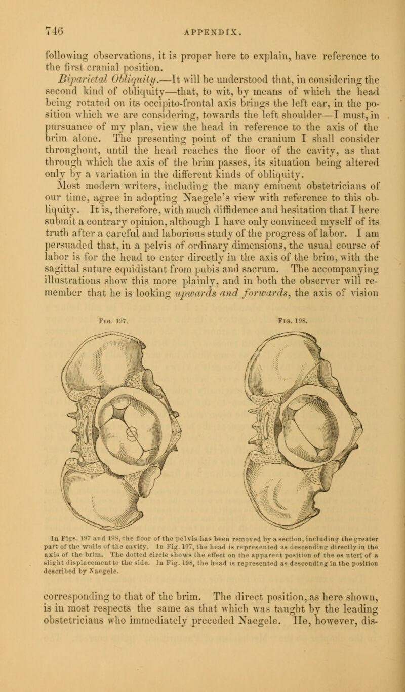 46 following observations, it is proper here to explain, have reference to the first cranial position. BiparieteU Obliquity.—It will be understood that, in considering the second kind of obliquity—that, to wit, by means of which the head being rotated on its occipitofrontal axis brings the left ear. in the po- sition which we are considering, towards the left shoulder—I must, in pursuance of my plan, view the head in reference to the axis of the brim alone. The presenting point of the cranium I shall consider throughout, until the head reaches the floor of the cavity, as that through which the axis of the brim passes, its situation being altered only by a variation in the different kinds of obliquity. Most modern writers, including the many eminent obstetricians of our time, agree in adopting Naegele's view with reference to this ob- liquity. It is, therefore, with much diffidence and hesitation that I here submit a contrary opinion, although I have only convinced myself of its truth after a careful and laborious study of the progress of labor. I am persuaded that, in a pelvis of ordinary dimensions, the usual course of labor is for the head to enter directly in the axis of the brim, with the sagittal suture equidistant from pubis and sacrum. The accompanying illustrations show this more plainly, ami in both the observer will re- member that he is looking upwards and forwards, the axis of vision Fig. 197. Fig. IPS. In Fiirs. 197 and 10s, the floor of the pelvis has been removed by a section, including the Lrroater part of the walls of the cavity, in Fig. 197, the head i> r presented ;- descending directly in the axis of the brim. The dotted circle shows the effect on the apparent position of the os uteri of a Blight displacement to the side. In Fig. 19S, the head is represented as descending in the position described by Xaegele. corresponding to that of the brim. The direct position, as here shown, is in most respects the same as that which was taught by the leading obstetricians who immediately preceded Xaegele. He, however, dis-