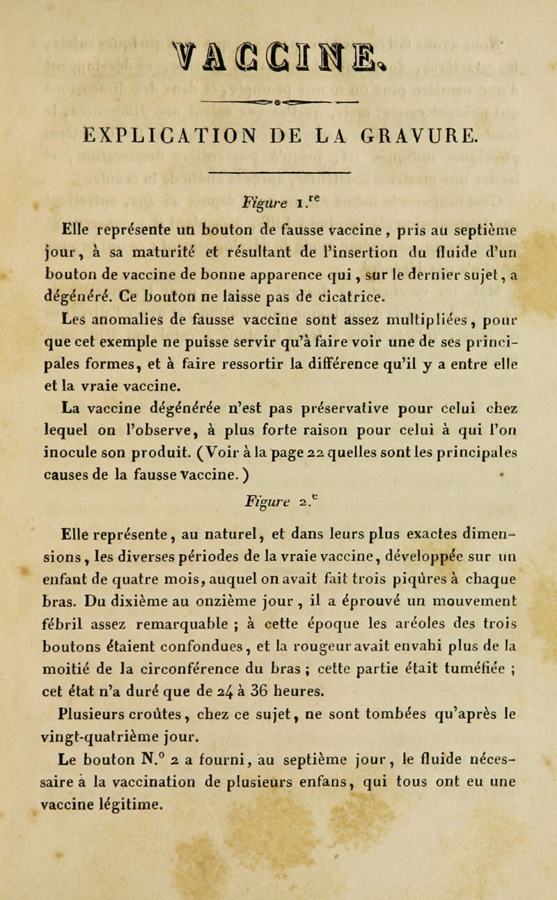 VACGXR& EXPLICATION DE LA GRAVURE. Figure i.re Elle représente un bouton de fausse vaccine , pris au septième jour, à sa maturité et résultant de l'insertion du fluide d'un bouton de vaccine de bonne apparence qui, sur le dernier sujet, a dégénéré. Ce bouton ne laisse pas de cicatrice. Les anomalies de fausse vaccine sont assez multipliées, pour que cet exemple ne puisse servir qu'à faire voir une de ses princi- pales formes, et à faire ressortir la différence qu'il y a entre elle et la vraie vaccine. La vaccine dégénérée n'est pas préservative pour celui chez lequel on l'observe, à plus forte raison pour celui à qui l'on inocule son produit. (Voir à la page 22 quelles sont les principales causes de la fausse Vaccine. ) Figure 2.e Elle représente, au naturel, et dans leurs plus exactes dimen- sions, les diverses périodes de la vraie vaccine, développée sur un enfant de quatre mois, auquel on avait fait trois piqûres à chaque bras. Du dixième au onzième jour, il a éprouvé un mouvement fébril assez remarquable ; à cette époque les aréoles des trois boutons étaient confondues, et la rougeur avait envahi plus de la moitié de la circonférence du bras ; cette partie était tuméfiée ; cet état n'a duré que de 24 a 36 heures. Plusieurs croûtes, chez ce sujet, ne sont tombées qu'après le vingt-quatrième jour. Le bouton N.° 2 a fourni, au septième jour, le fluide néces- saire à la vaccination de plusieurs enfans, qui tous ont eu une vaccine légitime.