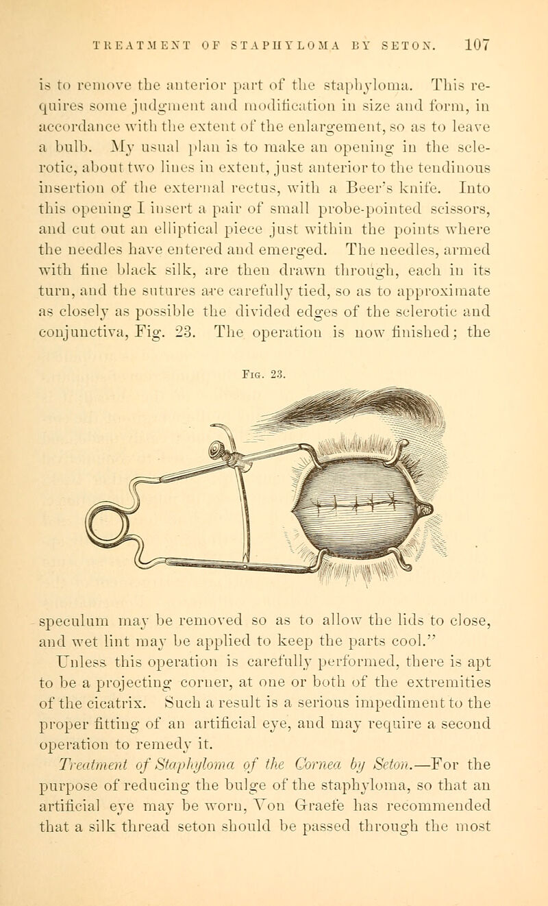 is to remove the anterior part of the staphyloma. This re- quires some judgment and modification in size and form, in accordance with the extent of the enlargement, so as to leave a bulb. My usual plan is to make an opening in the scle- rotic, about two lines in extent, just anterior to the tendinous insertion of the external rectus, with a Beer's knife. Into this opening I insert a pair of small probe-pointed scissors, and cut out an elliptical piece just within the points where the needles have entered and emerged. The needles, armed with fine black silk, are then drawn through, each in its turn, and the sutures are carefully tied, so as to approximate as closely as possible the divided edges of the sclerotic aud conjunctiva, Fig. 23. The operation is uow finished; the Fig. 23. speculum may be removed so as to allow the lids to close, and wet lint may be applied to keep the parts cool. Unless this operation is carefully performed, there is apt to be a projecting corner, at one or both of the extremities of the cicatrix. Such a result is a serious impediment to the proper fitting of an artificial eye, and may recpaire a second operation to remedy it. Treatment of Staphyloma of the Cornea by Seton.—For the purpose of reducing the bulge of the staphyloma, so that an artificial eye may be worn, Von Graefe has recommended that a silk thread seton should be passed through the most