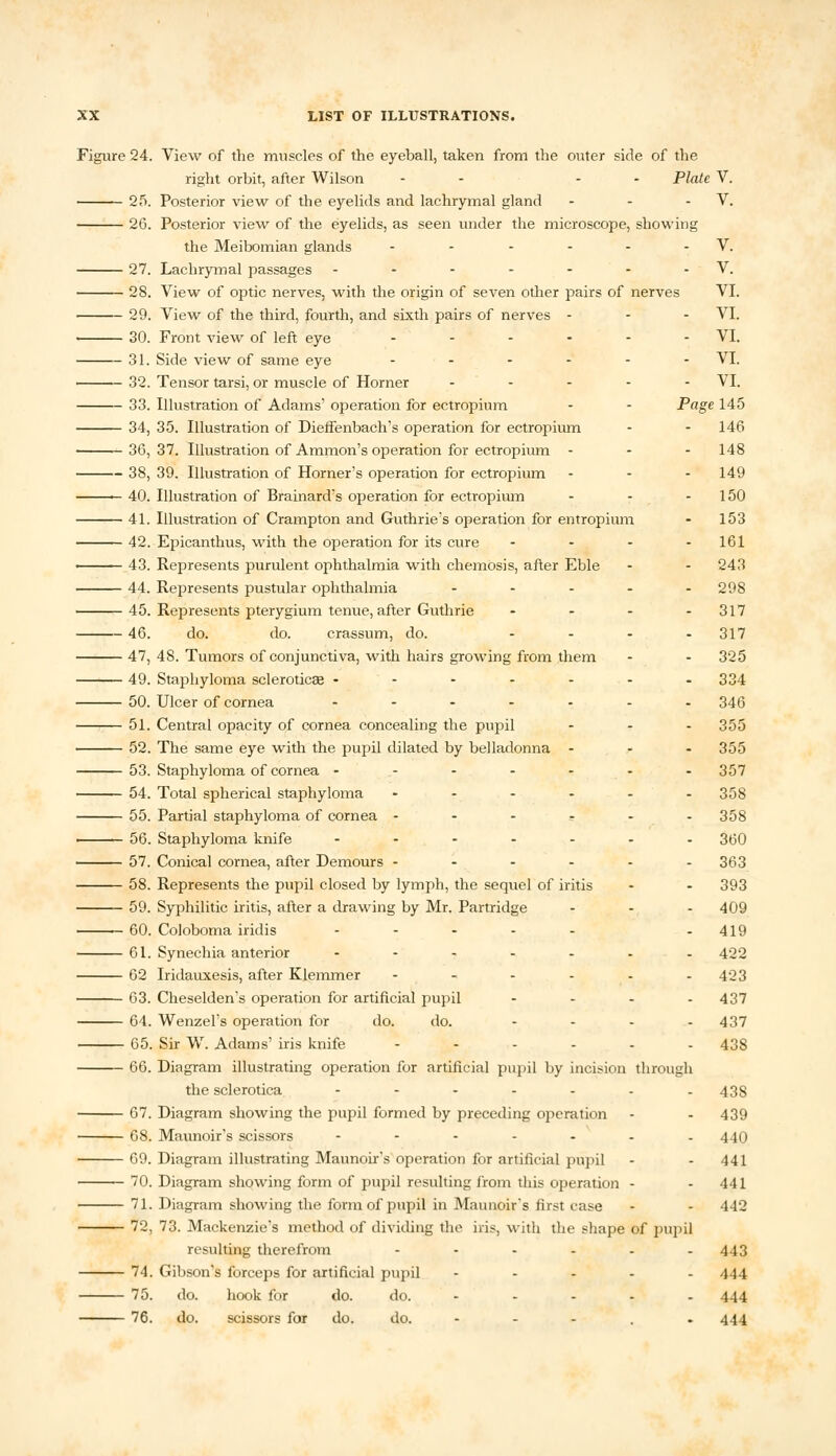 Figure 24. View of the muscles of the eyeball, taken from the outer side of the right orbit, after Wilson - - - Plate V. 25. Posterior view of the eyelids and lachrymal gland - - V. 26. Posterior view of the eyelids, as seen under the microscope, showing the Meibomian glands - - - - - - V. 27. Lachrymal passages - - - - - - -V. 28. View of optic nerves, with the origin of seven other pairs of nerves VI. 29. View of the third, fourth, and sixth pairs of nerves - - - VI. 30. Front view of left eye ...... VI. 31. Side view of same eye ...... VI. 32. Tensor tarsi, or muscle of Horner ..... VI. 33. Illustration of Adams' operation for ectropium - - Page 145 34, 35. Illustration of Dieffenbach's operation for ectropium - - 146 36, 37. Illustration of Amnion's operation for ectropium - - - 148 38, 39. Illustration of Horner's operation for ectropium ... 149 — 40. Illustration of Brainard's operation for ectropium - - - 150 41. Illustration of Crampton and Guthrie's operation for entropium - 153 42. Epicanthus, with the operation for its cure .... 161 43. Represents purulent ophthalmia with chemosis, after Eble - - 243 44. Represents pustular ophthalmia ..... 298 45. Represents pterygium tenue, after Guthrie - - - 317 46. do. do. crassum, do. .... 317 47, 48. Tumors of conjunctiva, with hairs growing from them - - 325 49. Staphyloma sclerotica? ------. 334 50. Ulcer of cornea ....... 34Q 51. Central opacity of cornea concealing the pupil ... 355 52. The same eye with the pupil dilated by belladonna ... 355 53. Staphyloma of cornea ------- 357 54. Total spherical staphyloma ------ 358 55. Partial staphyloma of cornea - - - ? - - 358 56. Staphyloma knife ---.... 260 57. Conical cornea, after Demours ------ 363 58. Represents the pupil closed by lymph, the sequel of iritis - - 393 59. Syphilitic iritis, after a drawing by Mr. Partridge ... 409 60. Coloboma iridis - - - - - -419 61. Synechia anterior ---.... 402 62 Iridauxesis, after Klemmer - - - - - - 423 63. Cheselden's operation for artificial pupil .... 437 64. Wenzel's operation for do. do. .... 437 65. Sir W. Adams' iris knife ...... 438 66. Diagram illustrating operation for artificial pupil by incision through the sclerotica -----.. 433 67. Diagram showing the pupil formed by preceding operation - - 439 68. Maunoir's scissors -----.. 440 69. Diagram illustrating Maunoir's operation for artificial pupil - - 441 ■ — 70. Diagram showing form of pupil resulting from this operation - - 441 71. Diagram showing the form of pupil in Maunoir's first case - - 442 72, 73. Mackenzie's method of dividing the iris, with the shape of pupil resulting therefrom ------ 443 74. Gibson's forceps for artificial pupil - 444 75. do. hook for do. do. 444 76. do. scissors for do. do. 444