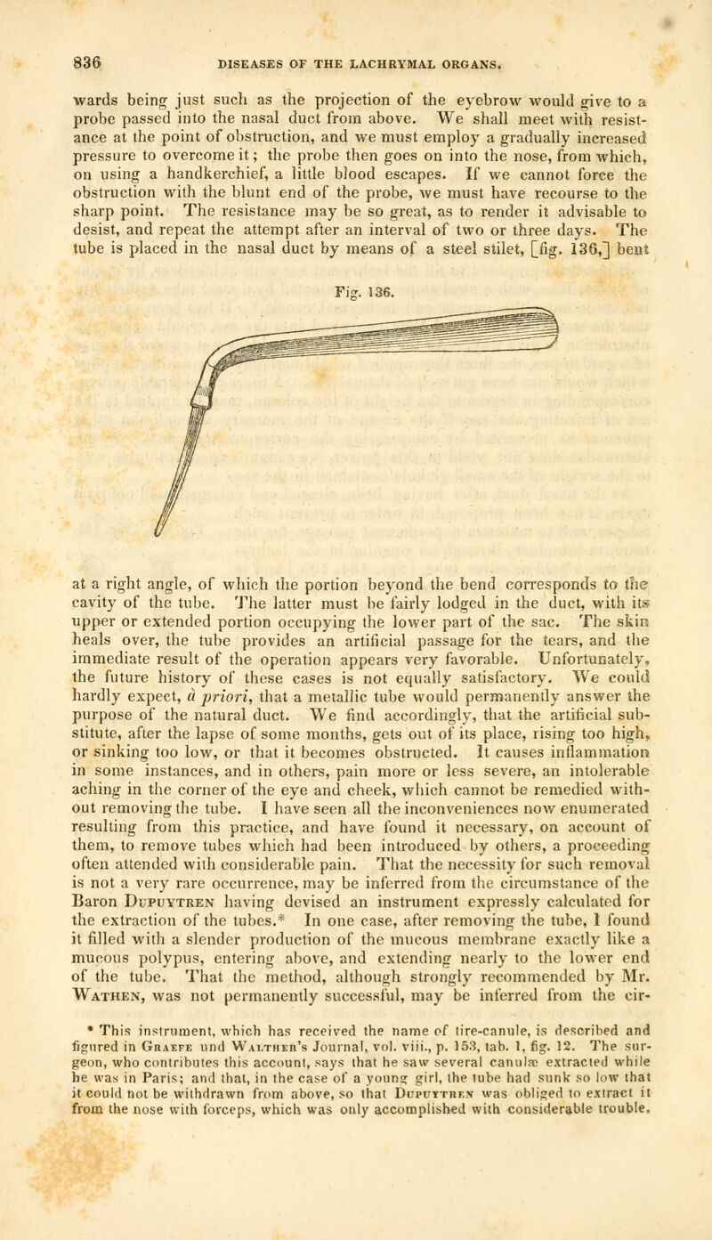 wards being just such as the projection of the eyebrow would give to a probe passed into the nasal duct from above. We shall meet with resist- ance at the point of obstruction, and we must employ a gradually increased pressure to overcome it; the probe then goes on into the nose, from which, on using a handkerchief, a little blood escapes. If we cannot force the obstruction with the blunt end of the probe, we must have recourse to the sharp point. The resistance may be so great, as to render it advisable to desist, and repeat the attempt after an interval of two or three days. The tube is placed in the nasal duct by means of a steel stilet, [fig. 136,] bent ri?. 136. at a right angle, of which the portion beyond the bend corresponds to the cavity of the tube. The latter must be fairly lodged in the duct, with its upper or extended portion occupying the lower part of the sac. The skin heals over, the tube provides an artificial passage for the tears, and the immediate result of the operation appears very favorable. Unfortunately, the future history of these cases is not equally satisfactory. We could hardly expect, a priori, that a metallic tube would permanently answer the purpose of the natural duct. We find accordingly, that the artificial sub- stitute, after the lapse of some months, gets out of its place, rising too high, or sinking too low, or that it becomes obstructed. It causes inflammation in some instances, and in others, pain more or less severe, an intolerable aching in the corner of the eye and cheek, which cannot be remedied with- out removing the tube. I have seen all the inconveniences now enumerated resulting from this practice, and have found it necessary, on account of them, to remove tubes which had been introduced by others, a proceeding often attended with considerable pain. That the necessity for such removal is not a very rare occurrence, may be inferred from the circumstance of the Baron Dupuytren having devised an instrument expressly calculated for the extraction of the tubes.* In one case, after removing the tube, 1 found it filled with a slender production of the mucous membrane exactly like a mucous polypus, entering above, and extending nearly to the lower end of the tube. That the method, although strongly recommended by Mr. Wathen, was not permanently successful, may be inferred from the cir- * This instrument, which has received the name of tire-canule, is described and figured in Graefe und Walthiu's Journal, vol. viii., p. 153, tab. 1, fig. 12. The sur- geon, who contributes this account, says that he saw several canulsc extracted while he was in Paris; and that, in the case of a young girl, the tube had sunk so low that it could not be withdrawn from above, so that Dcputtrkx was obliged to extract it from the nose with forceps, which was only accomplished with considerable trouble.