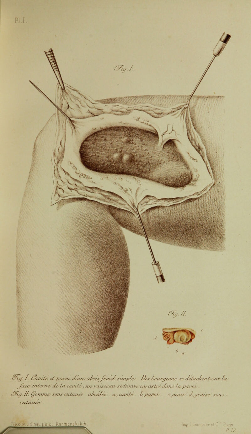 c'n/ /. ( an/r ce paroi .liai a&CGsfroicù simple Des ùourqc&ius st. tleéa. cfi£né>sur Lu /<ur interne </r f<i tarife ,/zn vaisseau se/trouve encastreaaju ut paroi r'^/./ //. (jûm/nr SO?ZS CUÙUICC .if-irJrc <i cari/e />/htfi'I >■ pe.tu . ,/ ,/raist SOUS cutanée y \
