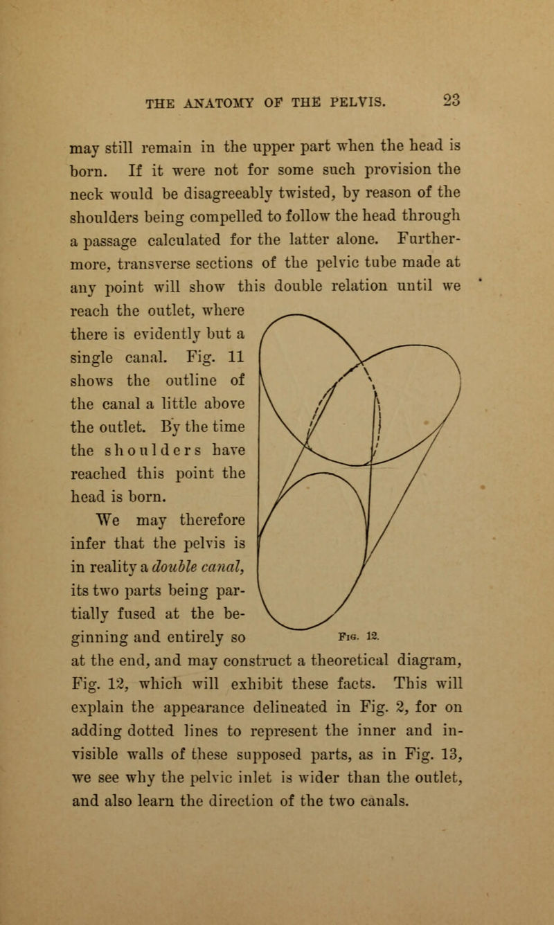 may still remain in the upper part when the head is born. If it were not for some such provision the neck would be disagreeably twisted, by reason of the shoulders being compelled to follow the head through a passage calculated for the latter alone. Farther- more, transverse sections of the pelvic tube made at any point will show this double relation until we reach the outlet, where there is evidently but a single canal. Fig. 11 shows the outline of the canal a little above the outlet. By the time the shoulders have reached this point the head is born. We may therefore infer that the pelvis is in reality a double canal, its two parts being par- tially fused at the be- ginning and entirely so Fig. 12. at the end, and may construct a theoretical diagram, Fig. 12, which will exhibit these facts. This will explain the appearance delineated in Fig. 2, for on adding dotted lines to represent the inner and in- visible walls of these supposed parts, as in Fig. 13, we see why the pelvic inlet is wider than the outlet, and also learn the direction of the two canals.