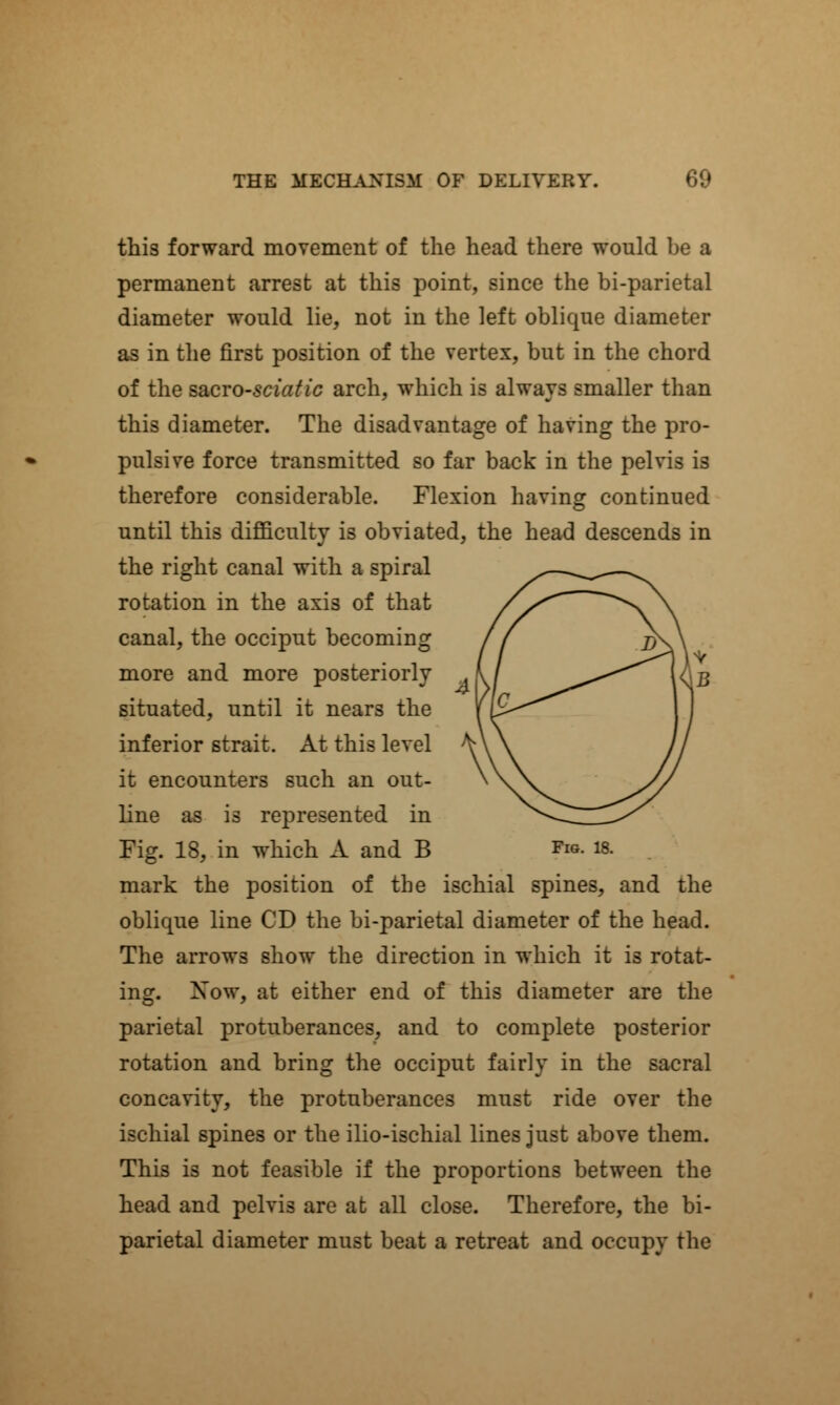 this forward movement of the head there would be a permanent arrest at this point, since the bi-parietal diameter would lie, not in the left oblique diameter as in the first position of the vertex, but in the chord of the ssLcro-sciatic arch, which is always smaller than this diameter. The disadvantage of having the pro- pulsive force transmitted so far back in the pelvis is therefore considerable. Flexion having continued until this difficulty is obviated, the head descends in the right canal with a spiral rotation in the axis of that canal, the occiput becoming more and more posteriorly situated, until it nears the inferior strait. At this level it encounters such an out- line as is represented in Fig. 18, in which A and B ?»■ w. mark the position of the ischial spines, and the oblique line CD the bi-parietal diameter of the head. The arrows show the direction in which it is rotat- ing. Xow, at either end of this diameter are the parietal protuberances, and to complete posterior rotation and bring the occiput fairly in the sacral concavity, the protuberances must ride over the ischial spines or the ilio-ischial lines just above them. This is not feasible if the proportions between the head and pelvis are at all close. Therefore, the bi- parietal diameter must beat a retreat and occupy the