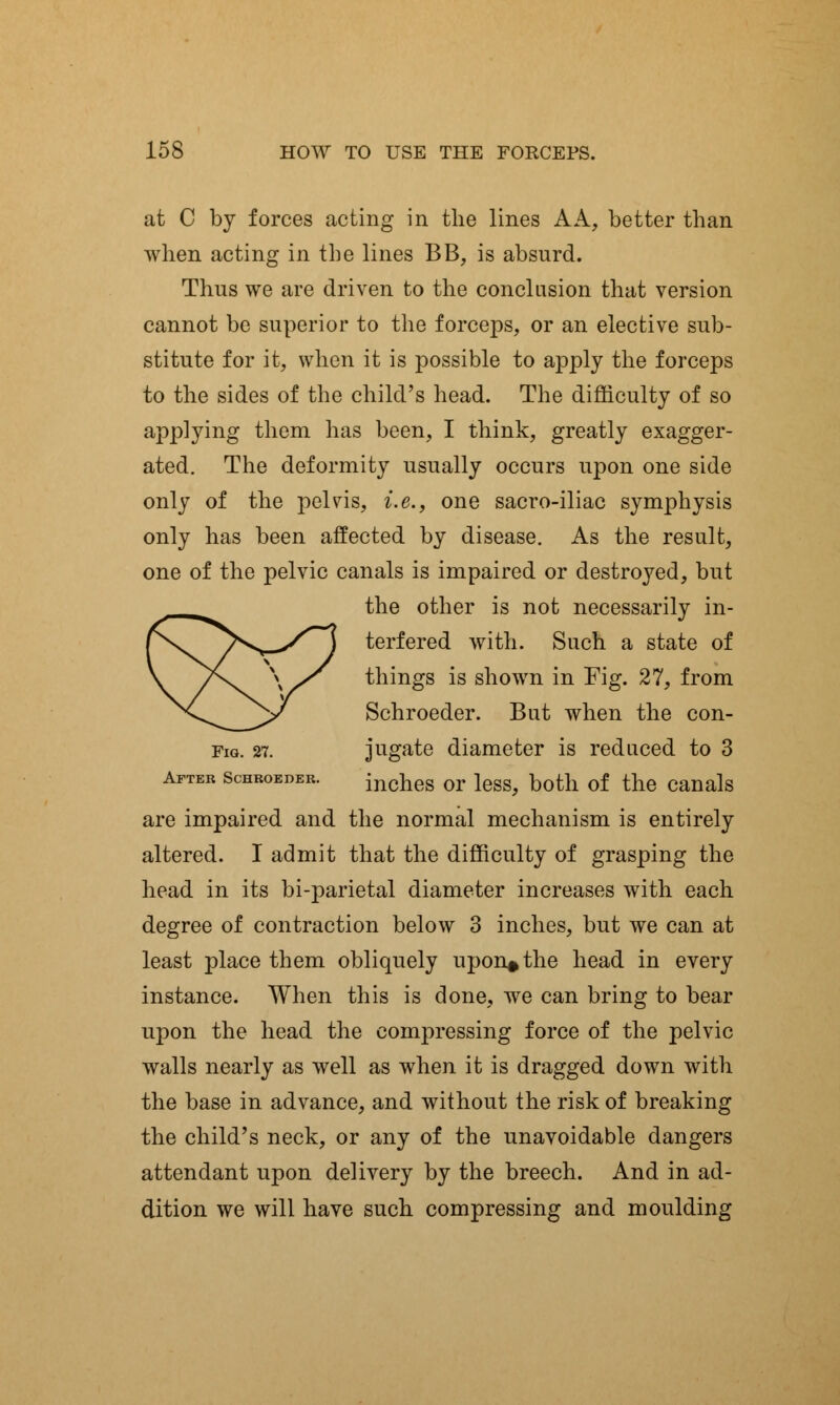 at C by forces acting in the lines A A, better than when acting in the lines BB, is absurd. Thus we are driven to the conclusion that version cannot be superior to the forceps, or an elective sub- stitute for it, when it is possible to apply the forceps to the sides of the child's head. The difficulty of so applying them has been, I think, greatly exagger- ated. The deformity usually occurs upon one side only of the pelvis, i.e., one sacro-iliac symphysis only has been affected by disease. As the result, one of the pelvic canals is impaired or destroyed, but the other is not necessarily in- terfered with. Such a state of things is shown in 'Fig. 27, from Schroeder. But when the con- Fig. 27. jugate diameter is reduced to 3 After Schroeder. inches Or leSS, both of the Canals are impaired and the normal mechanism is entirely altered. I admit that the difficulty of grasping the head in its bi-parietal diameter increases with each degree of contraction below 3 inches, but we can at least place them obliquely upon* the head in every instance. When this is done, we can bring to bear upon the head the compressing force of the pelvic walls nearly as well as when it is dragged down with the base in advance, and without the risk of breaking the child's neck, or any of the unavoidable dangers attendant upon delivery by the breech. And in ad- dition we will have such compressing and moulding