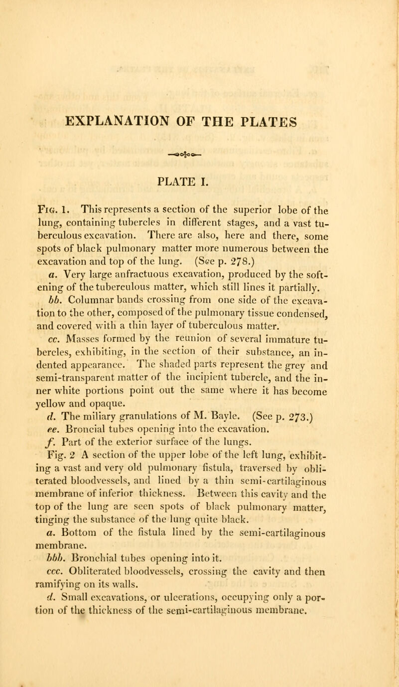 EXPLANATION OF THE PLATES PLATE I. Fig. 1. This represents a section of the superior lobe of the lung, containing tubercles in different stages, and a vast tu- berculous excavation. There are also, here and there, some spots of black pulmonary matter more numerous between the excavation and top of the lung. (See p. 278.) a. Very large anfractuous excavation, produced by the soft- ening of the tuberculous matter, which still lines it partially. bb. Columnar bands crossing from one side of the excava- tion to the other, composed of the pulmonary tissue condensed, and covered with a thin layer of tuberculous matter. cc. Masses formed by the reunion of several immature tu- bercles, exhibiting, In the section of their substance, an In- dented appearance. The shaded parts represent the grey and semi-transparent matter of the Incipient tubercle, and the In- ner white portions point out the same where It has become yellow and opaque. d. The miliary granulations of M. Bayle. (See p. 273.) ee. Broncial tubes opening Into the excavation. f. Part of the exterior surface of the lungs. Fig. 2 A section of the upper lobe of the left lung, exhibit- ing a vast and very old pulmonary fistula, traversed by obli- terated bloodvessels, and lined by a thin semi-cartilaginous membrane of Inferior thickness. Between this cavity and the top of the lung are seen spots of black pulmonary matter, tinging the substance of the lung quite black. a. Bottom of the fistula lined by the semi-cartilaginous membrane. hbb. Bronchial tubes opening into it. ccc. Obliterated bloodvessels, crossing the cavity and then ramifying on its walls. d. Small excavations, or ulcerations, occupying only a por- tlon of the thickness of the semi-cartilaginous membrane.