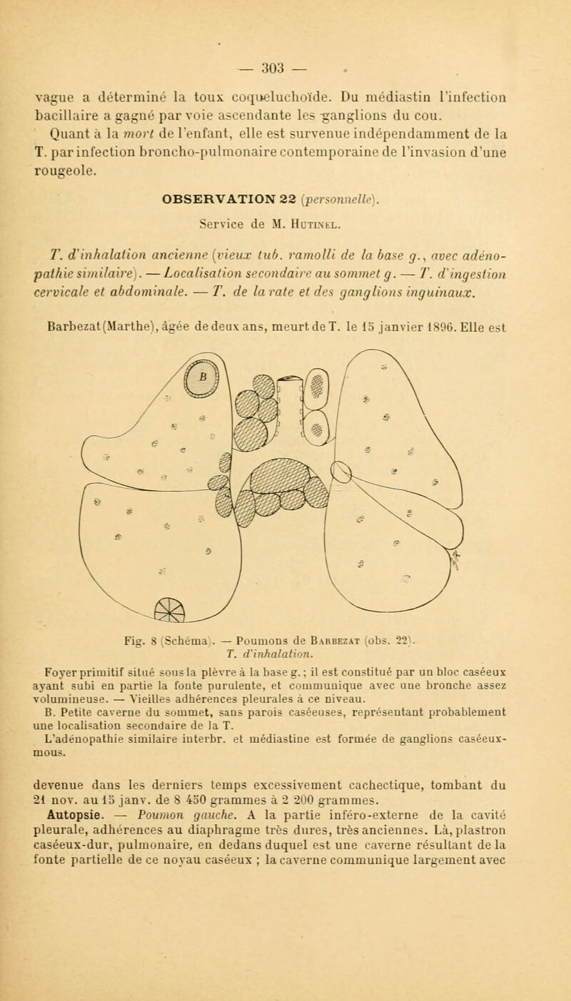 vague a déterminé la toux coqueluchoïde. Du médiastin l'infection bacillaire a gagné par voie ascendante les -ganglions du cou. Quant à la mort de l'enfant, elle est survenue indépendamment de la T. par infection broncho-pulmonaire contemporaine de l'invasion d'une rougeole. OBSERVATION 32 (personnelle). Service de M. Hutlnel. T. d'inhalation ancienne (vieux tub. ramolli de la base g., avec adéno- pathie similaire). —Localisation secondaire au sommet g. — T. d'ingestion cervicale et abdominale. — T. de la rate et des ganglions inguinaux. Barbezat (Marthe), âgée de deux ans, meurt de T. le 15 janvier 1896. Elle est Fig. 8 (Schéma . — Poumons de Barbezat (obs. 22). T. d'inhalation. Foyer primitif situé sous la plèvre à la base g. ; il est constitué par un bloc caséeux ayant subi en partie la fonte purulente, et communique avec une bronche assez volumineuse. — Vieilles adhérences pleurales à ce niveau. B. Petite caverne du sommet, sans parois caséeuses, représentant probablement une localisation secondaire de la T. L'adéuopathie similaire interbr. et médiastine est formée de ganglions caséeux- mous. devenue dans les derniers temps excessivement cachectique, tombant du 21 nov. au 15 janv. de 8 450 grammes à 2 200 grammes. Autopsie. — Poumon gauche. A la partie inféro-externe de la cavité pleurale, adhérences au diaphragme très dures, très anciennes. Là, plastron caséeux-dur, pulmonaire, en dedans duquel est une caverne résultant de la fonte partielle de ce noyau caséeux ; la caverne communique largement avec