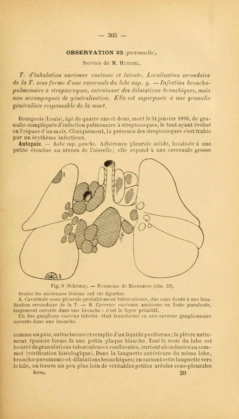 OBSERVATION 23 personnelle). Service de M. Hltlnel. T. d'inhalation ancienne caséeuse et latente. Localisation secondaire de la T. sorti forme d'une cavernule du lobe sup. g. —Infection broncho- pulmonaire à streptocoques, entraînant des dilatations bronchiques, ynais non accompagnée de généralisation. Elle est superposée à une granulie généralisée responsable de la mort. Bourgeois (Louis), âgé de quatre ans et demi, mort le 31 janvier 1896, de gra- nulie compliquée d'infection pulmonaire à streptocoques, le tout ayant évolué en l'espace d'un mois. Cliniquement, la présence des streptocoques s'est trahie par un érvthème infectieux. Autopsie. — Lobe sup. gauche. Adhérence pleurale solide, localisée à une petite étendue au niveau de l'aisselle; elle répond à une cavernule grosse Fig. 9 (Schéma). — Poumons de Bourgeois (obs. 23). Seules les anciennes lésions ont été figurées. A. Cavernule sous-pleurale probablement tuberculeuse, due sans doute à une loca- lisation secondaire de la T. — B. Caverne caséeuse ancienne en fonte purulente, largement ouverte dans une bronche : c'est le foyer primitif. Un des ganglions caséeux interbr. était transformé en une caverne ganglionnaire ouverte dans une bronche. comme un pois, anfrac tueuse et remplie d'un liquide purifor me; la plèvre nette- ment épaissie forme là une petite plaque blanche. Tout le reste du lobe est bourré de granulations tuberculeuses confiuentes, surtout abondantes au som- met (vérification histologique). Dans la languette antérieure du même lobe, broncho-pneumonie et dilatations bronchiques; en suivantcette languette vers le hile, on trouve un peu plus loin de véritables petites aréoles sous-pleurales Kcss. 20