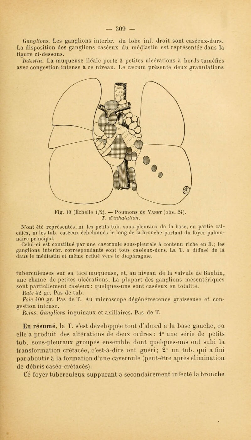 Ganglions. Les ganglions interbr. du lobe inf. droit sont caséeux-durs. La disposition des ganglions caséeux du médiastin est représentée dans la figure ci-dessous. Intestin. La muqueuse iléale porte 3 petites ulcéralions à bords tuméfiés avec congestion intense à ce niveau. Le cœcum présente deux granulations Fig. 10 (Échelle 1/2). — Poumons de Vanet (obs. 24). T. d'inhalation. N'ont été représentés, ni les petits tub. sous-pleuraux de la base, en partie cal- cifiés, ni les tub. caséeux échelonnés le long de la bronche partant du foyer pulmo- naire principal. Celui-ci est constitué par une cavcrnule sous-pleurale à coutenu riche en B.; les ganglions interbr. correspondants sont tous caséeux-durs. La T. a diffusé de là daus le médiastin et même reflué vers le diaphragme. tuberculeuses sur sa face muqueuse, et, au niveau de la valvule de Bauhin, une chaîne de petites ulcérations. La plupart des ganglions mésentériques sont partiellement caséeux: quelques-uns sont caséeux en totalité. Rate 42 gr. Pas de tub. Foie 400 gr. Pas de T. Au microscope dégénérescence graisseuse et con- gestion intense. Reins. Ganglions inguinaux et axillaires. Pas de T. En résumé, la T. s'est développée tout d'abord à la base gauche, où elle a produit des altérations de deux ordres : 1° une série de petits tub. sous-pleuraux groupés ensemble dont quelques-uns ont subi la transformation crétacée, c'est-à-dire ont guéri; 2° un tub. qui a fini par aboutir à la formation d'une cavernule (peut-être après élimination de débris caséo-crétacés). Ce foyer tuberculeux suppurant a secondairement infecté la bronche