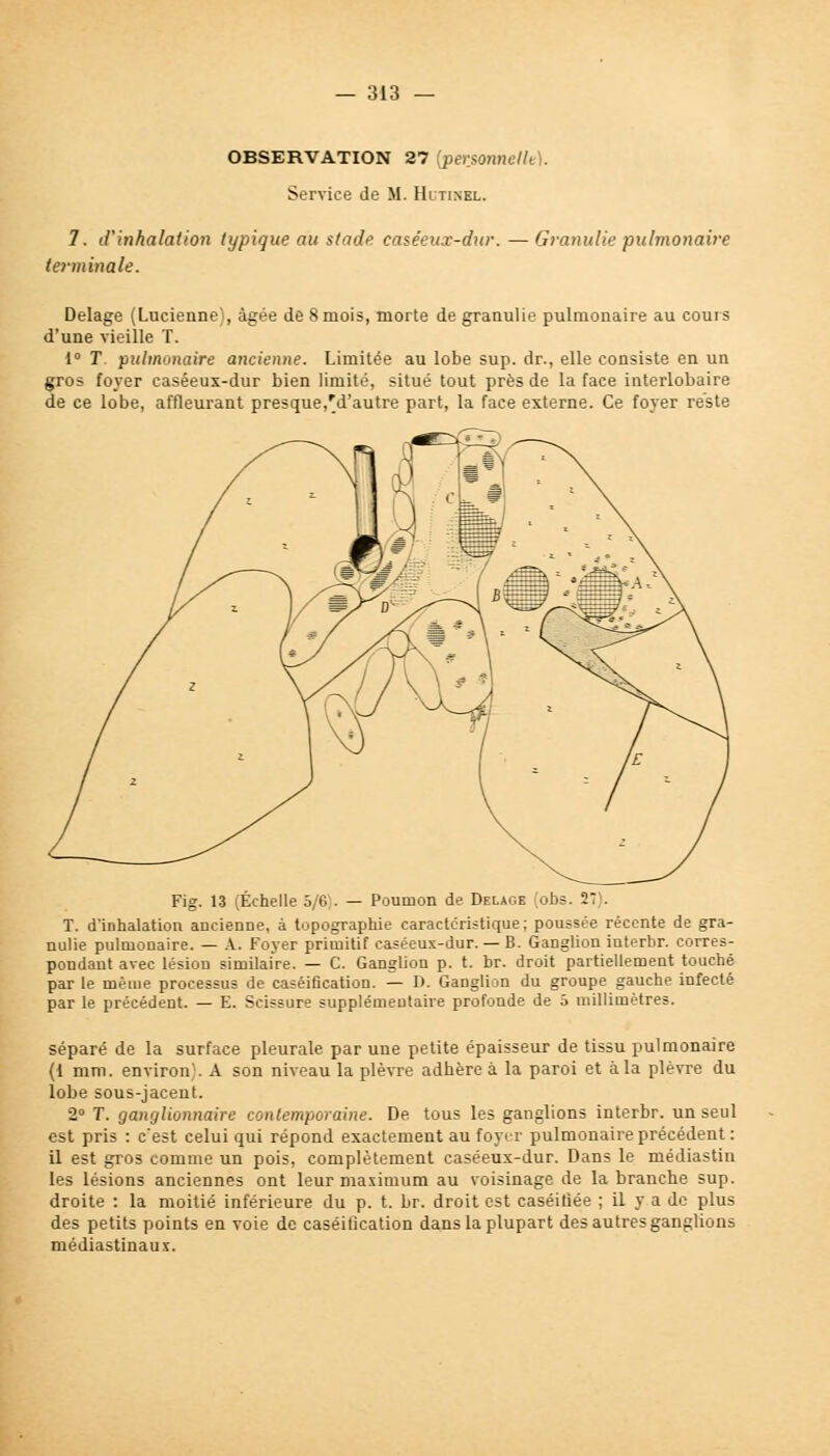 OBSERVATION 27 {personnelle). Service de M. Hltinel. 7. d'inhalation typique au stade caséeux-dw. — Granulie pulmonaire terminale. Delage (Lucienne), âgée de 8 mois, morte de granulie pulmonaire au cours d'une vieille T. 1° T. pulmonaire ancienne. Limitée au lobe sup. dr., elle consiste en un gros foyer caséeux-dur bien limité, situé tout près de la face interlobaire de ce lobe, affleurant presque.'d'autre part, la face externe. Ce foyer reste T. d'inhalation ancienne, Fig. 13 (Échelle 5/6). — Poumon de Delage obs. il . ', à topographie caractéristique; poussée récente de gra- nulie pulmonaire. — A. Foyer primitif caséeux-dur. — B. Ganglion interbr. corres- pondant avec lésion similaire. — C. Ganglion p. t. br. droit partiellement touché par le même processus de caséification. — D. Ganglion du groupe gauche infecté par le précédent. — E. Scissure supplémentaire profonde de 5 millimètres. séparé de la surface pleurale par une petite épaisseur de tissu pulmonaire (1 mm. environ). A son niveau la plèvre adhère à la paroi et à la plèvre du lobe sous-jacent. 2° T. ganglionnaire contemporaine. De tous les ganglions interbr. un seul est pris : c'est celui qui répond exactement au foyer pulmonaire précédent : il est gros comme un pois, complètement caséeux-dur. Dans le médiastin les lésions anciennes ont leur maximum au voisinage de la branche sup. droite : la moitié inférieure du p. t. br. droit est caséitiée ; il y a de plus des petits points en voie de caséification dans la plupart des autres ganglions médiastinaux.