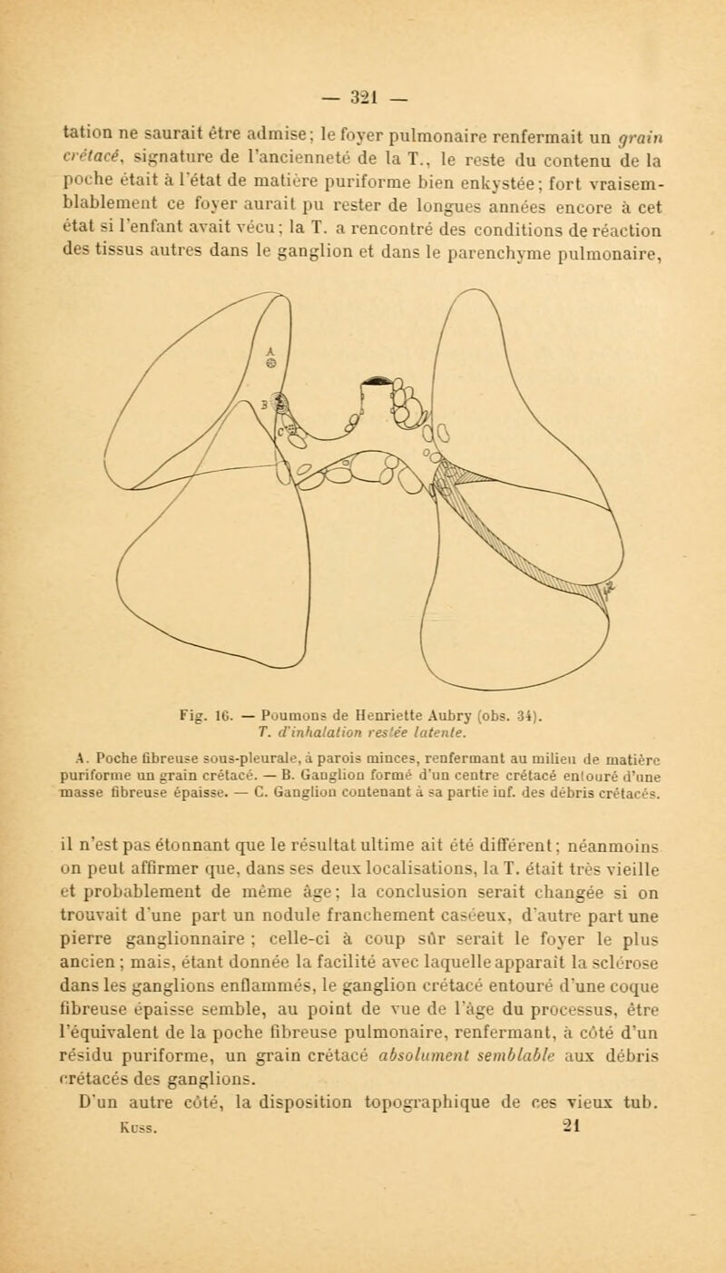 — 3-21 — tation ne saurait être admise; le foyer pulmonaire renfermait un grain crétacé, signature de l'ancienneté de la T., le reste du contenu de la poche était à l'état de matière puriforme bien enkystée; fort vraisem- blablement ce foyer aurait pu rester de longues années encore à cet étal si l'enfant avait vécu; la T. a rencontré des conditions de réaction des tissus autres dans le ganglion et dans le parenchyme pulmonaire, Fig. 16. — Poumons de Henriette Aubry (obs. 34). T. d'inhalation resiée latente. A. Poche fibreuse sous-pleurale, à parois minces, renfermant au milieu de matière puriforme un grain crétacé. — B. Ganglion formé d'un centre crétacé enlouré d'une masse fibreuse épaisse. — C. Ganglion contenant à sa partie inf. des débris crétacés. il n'est pas étonnant que le résultat ultime ait été différent ; néanmoins on peut affirmer que, dans ses deux localisations, la T. était très vieille et probablement de même âge ; la conclusion serait changée si on trouvait d'une part un nodule franchement casi-eux. d'autre part une pierre ganglionnaire ; celle-ci à coup sûr serait le foyer le plus ancien ; mais, étant donnée la facilité avec laquelle apparaît la sclérose dans les ganglions enflammés, le ganglion crétacé entouré d'une coque fibreuse épaisse semble, au point de vue de l'âge du processus, être l'équivalent de la poche fibreuse pulmonaire, renfermant, à côté d'un résidu puriforme, un grain crétacé absolument semblable aux débris crétacés des ganglions. D'un autre côté, la disposition topographique de ces vieux tub. Kuss. 21