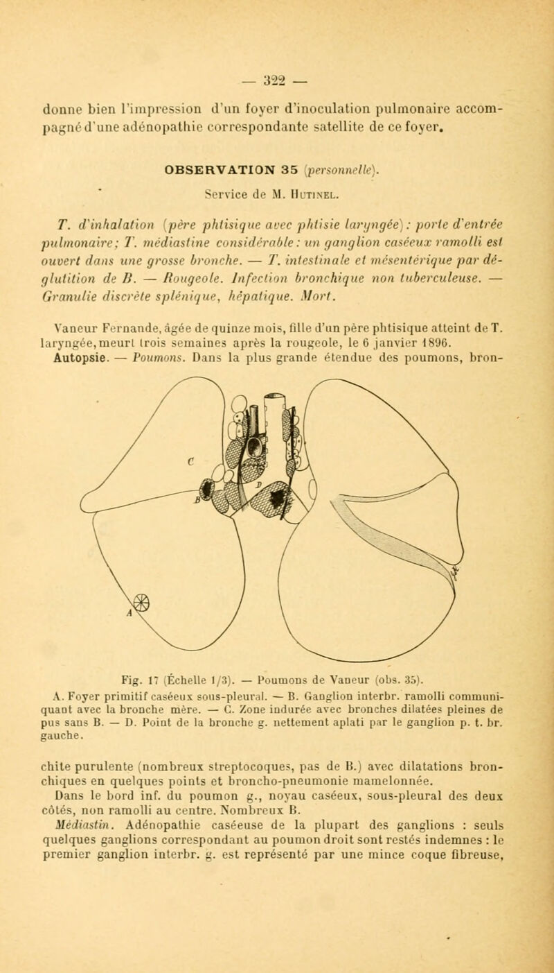 donne bien l'impression d'un foyer d'inoculation pulmonaire accom- pagné d'une adénopathie correspondante satellite de ce foyer. OBSERVATION 35 [personnelle). Service de M. Hutinel. T. d'inhalation [pare phtisique avec p/itisie laryngée): porte d'entrer pulmonaire ; T. ntcdiastine considérable : un ganglion caséeux ramolli est ouvert dans une grosse bronche. — T. intestinale et mésentérique par dé- glutition de li. — Rougeole. Infection bronchique non tuberculeuse. — Granulie discrète splénique, hépatique. Mort. Vancur Fernande, âgée de quinze mois, fdle d'un père phtisique atteint de T. laryngée,meurt trois semaines après la rougeole, le 6 janvier 1896. Autopsie. — Poumons. Dans la plus grande étendue des poumons, bron- Fig. 17 (Échelle 1/3). — Poumons de VaDeur (obs. 35). A. Foyer primitif caséeux sous-pleural. — B. Ganglion interbr. ramolli communi- quant avec la broDche mère. — C. Zone indurée avec bronches dilatées pleines de pus sans B. — D. Point de la bronche g. nettement aplati par le ganglion p. t. br. gauche. chite purulente (nombreux streptocoques, pas de B.) avec dilatations bron- chiques en quelques points et broncho-pneumonie mamelonnée. Dans le bord inf. du poumon g., noyau caséeux, sous-pleural des deux côtés, non ramolli au centre. Nombreux B. Médiastin. Adénopathie caséeuse de la plupart des ganglions : seuls quelques ganglions correspondant au poumon droit sont restés indemnes : le premier ganglion interbr. g. est représenté par une mince coque fibreuse,