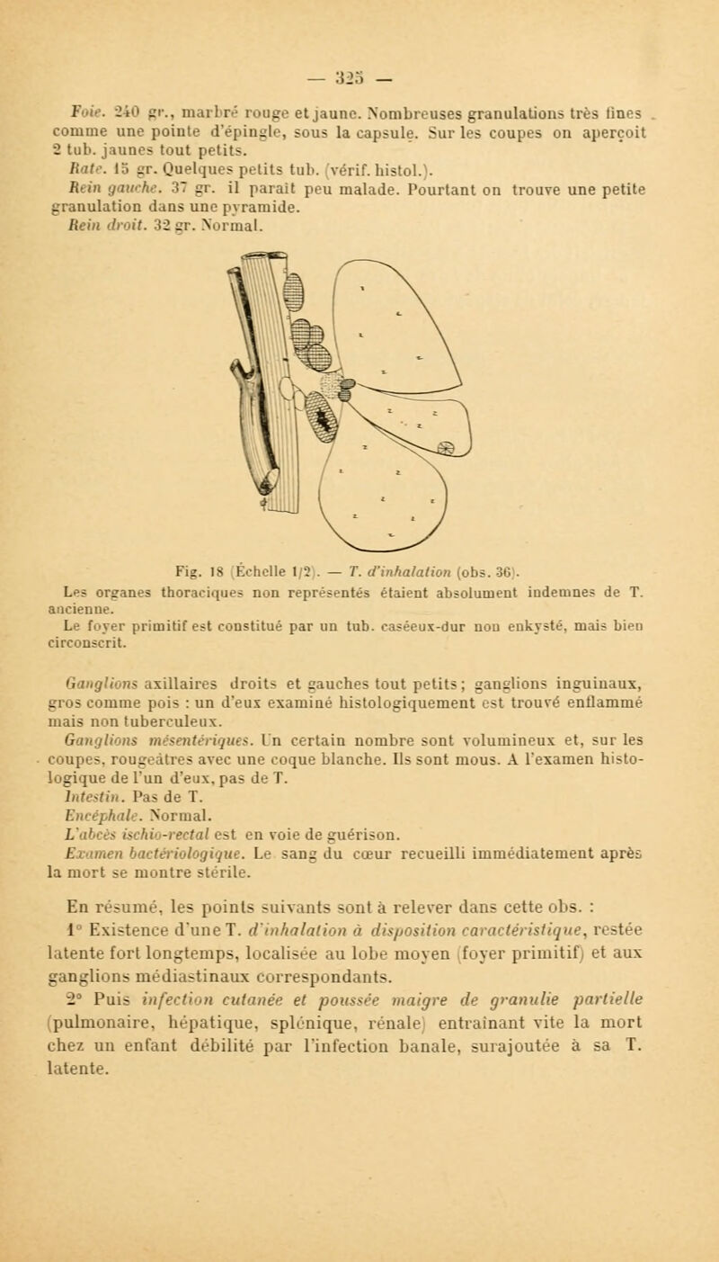 Fui,-. Jio gr., marbré rouge et jaune. Nombreuses granulations très fines . comme une pointe d'épingle, sous la capsule. Sur les coupes on aperçoit 2 tub. jaunes tout petits. Rat.\ 15 gr. Quelques petits tub. (vérif. histol.). Rein gauche. 37 gr. il parait peu malade. Pourtant on trouve une petite granulation dans une pyramide. Rein droit. 32gr. Normal. Fig. 18 ;Echclle 1,3 . — T. d'inhalation (obs. 36). Les organes thoraciques non représentés étaient absolument indemnes de T. ancienne. Le foyer primitif est constitué par un tub. easéeux-dur non enkysté, mais bien circonscrit. Ganglions axillaires droits et cauches tout petits ; ganglions inguinaux, gros comme pois : un d'eus examiné histologiquement est trouvé enflammé mais non tuberculeux. Ganglions mésentériques. In certain nombre sont volumineux et, sur les coupes, rougeàtres avec une coque blanche. Ils sont mous. A l'examen histo- logique de l'un d'eux, pas de T. Intestin. Pas de T. Encéphale. Normal. L'abcès ischi -rectal est en voie de guérison. Examen bactériologique. Le sang du cœur recueilli immédiatement après la mort se montre stérile. En résumé, les points suivants sont à relever dans cette obs. : 1° Existence d'une T. d'inhalation à disposition caractéristique, restée latente fort longtemps, localisée au lobe moyen foyer primitif) et aux ganglions médiastinaux correspondants. 2° Puis infection cutanée et poussée maigre de gmnulie partielle (pulmonaire, hépatique, splénique, rénale entraînant vite la mort chez un enfant débilité par l'infection banale, surajoutée à sa T. latente.