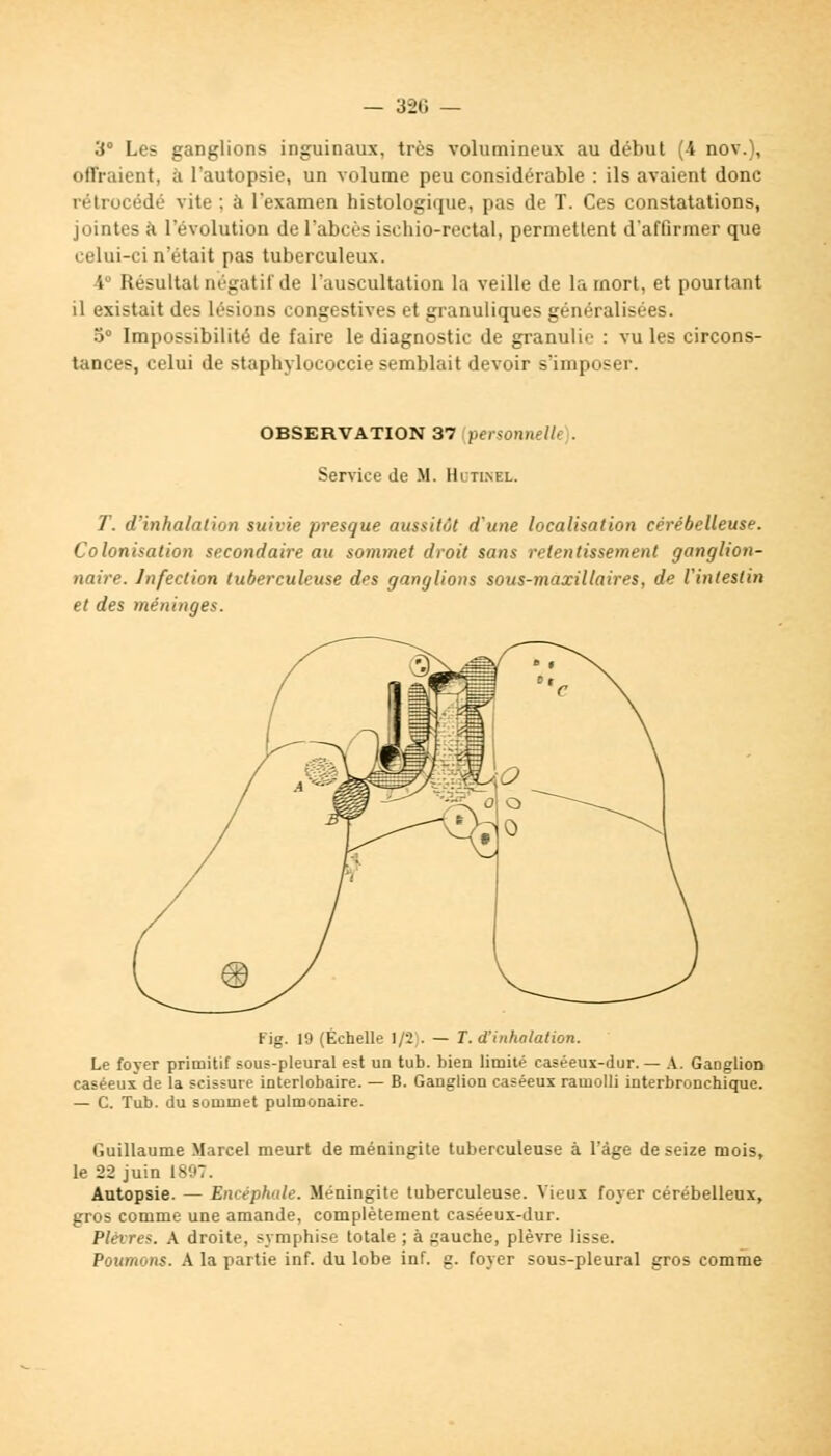 3° Les ganglions inguinaux, très volumineux au début (4 nov.), offraient, à l'autopsie, un volume peu considérable : ils avaient donc rétrocédé vite ; à l'examen histologique, pas de T. Ces constatations, jointes à l'évolution de l'abcès ischio-rectal, permettent d'affirmer que celui-ci n'était pas tuberculeux. i Résultat négatif de l'auscultation la veille de la mort, et pourtant il existait des lésions congestives et granuliques généralisées. 3° Impossibilité de faire le diagnostic de granulie : vu les circons- tances, celui de staphylococcie semblait devoir s'imposer. OBSERVATION 37 penonnell> . Service de il. Hitinel. T. d'inhalation suivie presque aussitôt d'une localisation cérébelleuse. Colonisation secondaire au sommet droit sans retentissement ganglion- naire. Infection tuberculeuse des ganglions sous-maxillaires, de l'intestin et des méninges. Fig. 19 (Échelle 1/2 . — T. d'inhalation. Le foyer primitif sous-pleural est un tub. bien limité caséeux-dur. — A. Ganglion caséeux de la scissure interlobaire. — B. Ganglion caséeux ramolli interbronchique. — C. Tub. du sommet pulmonaire. Guillaume Marcel meurt de méningite tuberculeuse à l'âge de seize mois, le 22 juin 1897. Autopsie. — Encéphale. Méningite tuberculeuse. Vieux foyer cérébelleux, gros comme une amande, complètement caséeux-dur. Plèvres. A droite, symphise totale ; à gauche, plèvre lisse. Poumons. A la partie inf. du lobe inf. g. foyer sous-pleural gros comme