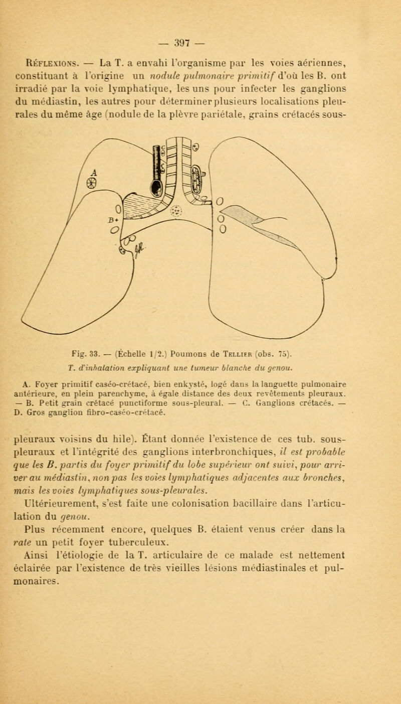 Réflexions. — La T. a envahi l'organisme par les voies aériennes, constituant à l'origine un nodule pulmonaire primitif d'où les B. ont irradié par la voie lymphatique, les uns pour infecter les ganglions du médiastin, les autres pour déterminer plusieurs localisations pleu- rales du même âge (nodule de la plèvre pariétale, grains crétacés sous- Fig. 33. — (Echelle 1/2.) Poumons de Tellieb (obs. 75). T. d'inhalation expliquant une tumeur blanche du genou. A. Foyer primitif caséo-crétacé, bien enkysté, logé dans la languette pulmonaire antérieure, en plein parenchyme, à égale distance des deux revêtements pleuraux. — B. Petit grain crétacé punctiforme sous-pleural. — C. Ganglions crétacés. — D. Gros ganglion fibro-caséo-crétacé. pleuraux voisins du hile). Étant donnée l'existence de ces tub. sous- pleuraux et l'intégrité des ganglions interbronchiques, il est probable que les B. partis du foyer primitif du lobe supérieur ont suivi, pour arri- ver au médiastin, non pas les voies lymphatiques adjacentes aux bronches, mais les voies lymphatiques sous-pleurales. Ultérieurement, s'est faite une colonisation bacillaire dans l'articu- lation du genou. Plus récemment encore, quelques B. étaient venus créer dans la rate un petit foyer tuberculeux. Ainsi l'étiologie de la T. articulaire de ce malade est nettement éclairée par l'existence de très vieilles lésions médiastinales et pul- monaires.