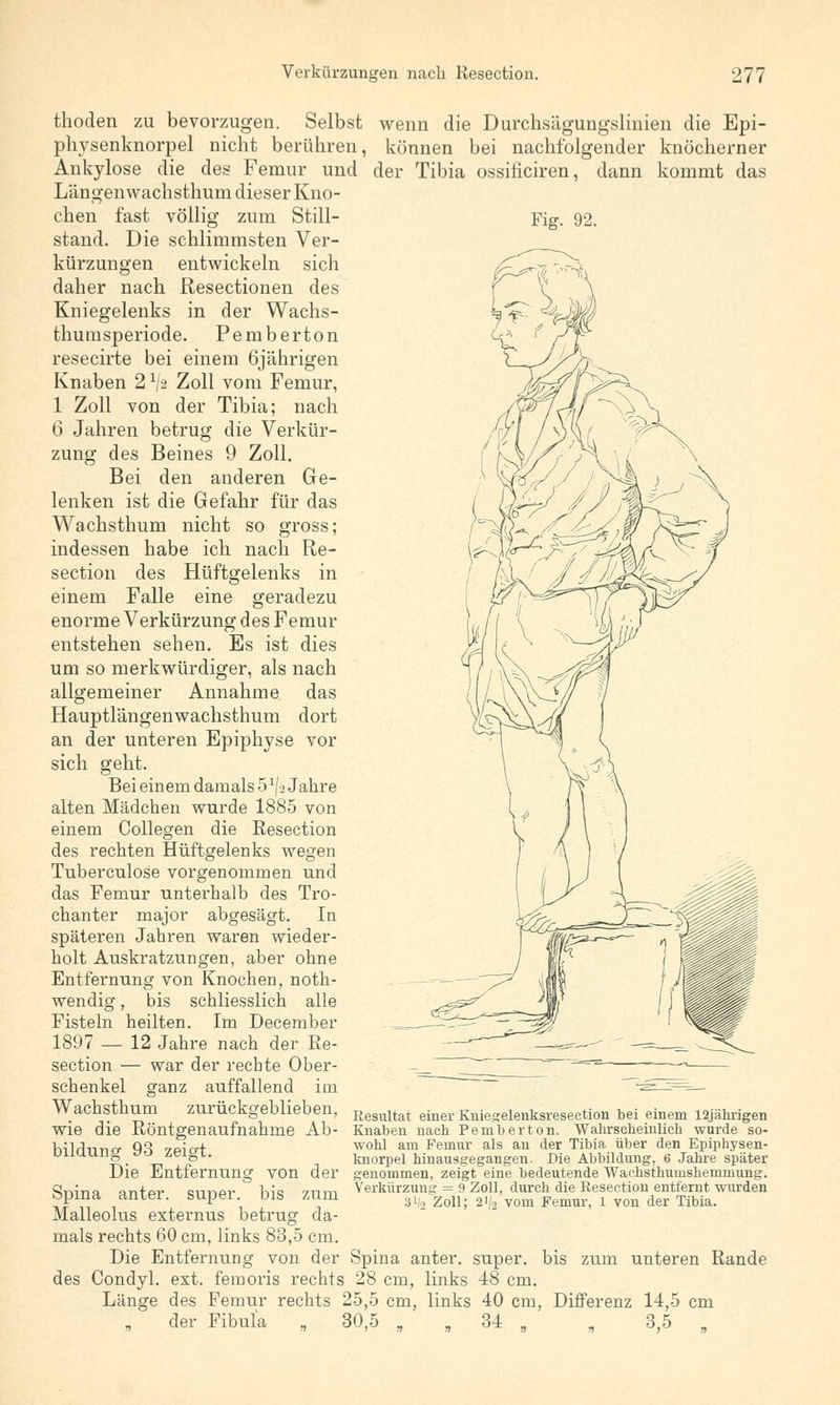 thoden zu bevorzugen. Selbst wenn die Durchsägungslinien die Epi- physenknorpel nicht berühren, können bei nachfolgender knöcherner Ankylose die des Femur und der Tibia ossificiren, dann kommt das Längen wachsthum dieser Kno- Fig. 92. chen fast völlig zum Still stand. Die schlimmsten Ver- kürzungen entwickeln sich daher nach Resectionen des Kniegelenks in der Wachs- thumsperiode. Pemberton resecirte bei einem 6jährigen Knaben 2 Va Zoll vom Femur, 1 Zoll von der Tibia; nach 6 Jahren betrug die Verkür- zung des Beines 9 Zoll. Bei den anderen Ge- lenken ist die Gefahr für das Wachsthum nicht so gross; indessen habe ich nach Re- section des Hüftgelenks in einem Falle eine geradezu enorme Verkürzung des Femur entstehen sehen. Es ist dies um so merkwürdiger, als nach allgemeiner Annahme das Hauptlängenwachsthum dort an der unteren Epiphyse vor sich geht. Bei einem damals 5 ^2 Jahre alten Mädchen wurde 1885 von einem Collegen die Resection des rechten Hüftgelenks wegen Tuberculose vorgenommen und das Femur unterhalb des Tro- chanter major abgesägt. In späteren Jahren waren wieder- holt Auskratzungen, aber ohne Entfernung von Knochen, noth- wendig, bis schliesslich alle Fisteln heilten. Im December 1897 — 12 Jahre nach der Re- section — war der rechte Ober- schenkel ganz auffallend im Wachsthum zurückgeblieben, wie die Röntgenaufnahme Ab- bildung 93 zeigt. Die Entfernung von der Spina anter. super, bis zum Malleolus externus betrug da- mals rechts 60 cm, links 83,5 cm. Die Entfernung von der Spina anter. super, bis des Condyl. ext. femoris rechts 28 cm, links 48 cm. Länge des Femur rechts 25,5 cm, links 40 cm, Differenz 14,5 cm . der Fibula . 30,5 . 34 „ . 3.5 . Resultat einer Kniegelenksresection bei einem 12jährigen Knaben nach Pemberton. Wahrscheinlich wurde so- wohl am Femur als an der Tibia über den Epiphysen- knorpel hinausgegangen. Die Abbildung, 6 Jahre später genommen, zeigt eine bedeutende Wachsthumshemmung. Verkürzung = 9 Zoll, durch die Resection entfernt wurden 3^2 Zoll; 2]/2 vom Femur, 1 von der Tibia. zum unteren Rande