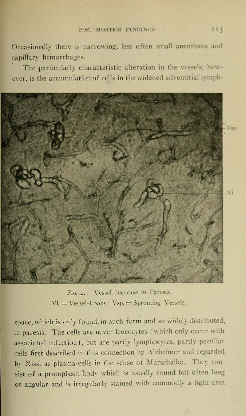 Occasionally there is narrowing, less often small aneurisms and capillary hemorrhages. The particularly characteristic alteration in the \ ever, is the accumulation of cells in the widened adventitial lymph- Fig. 27. Vessel Increase in Paresis. VI. = Vessel-Loops ; Vsp. = Sprouting Vessels. space, which is only found, in such form and so widely distributed, in paresis. The cells are never leucocytes (which only occur with associated infection), but are partly lymphocytes, partly peculiar cells first described in this connection by Alzheimer and regarded by Nissl as plasma-cells in the sense of Marschalko. They con- sist of a protoplasm body which is usually round but often long or angular and is irregularly stained with commonly a light area