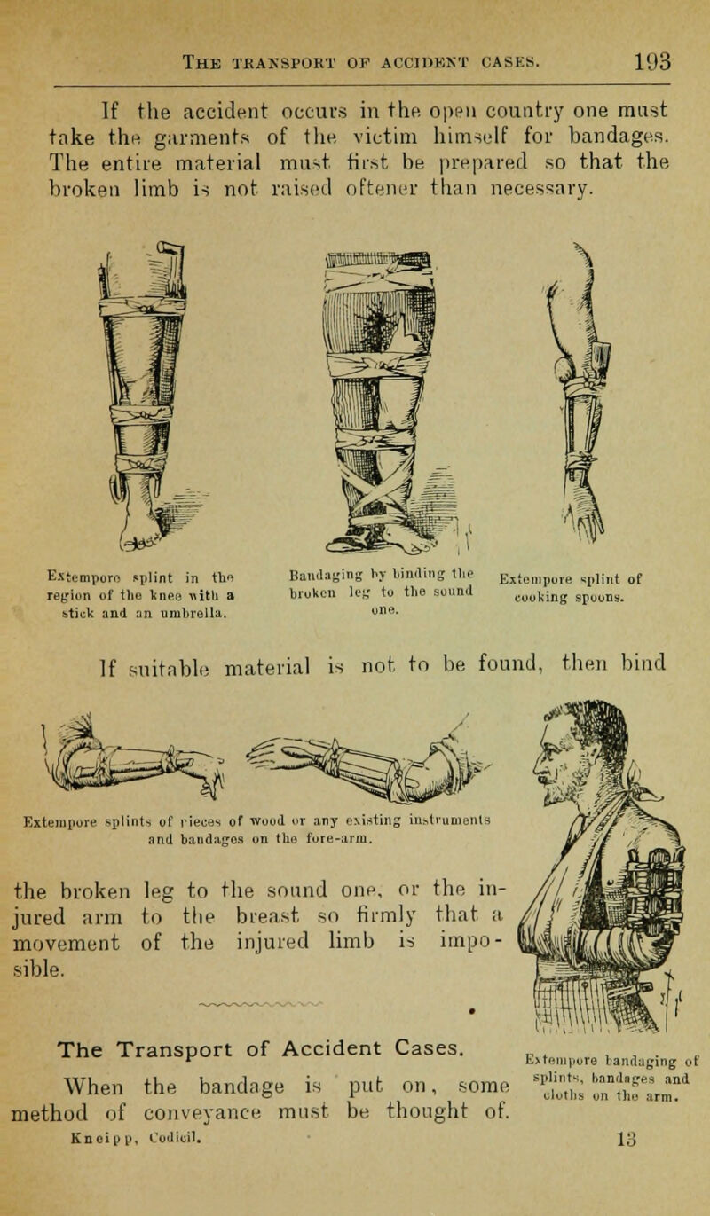 If the accident occurs in the open country one must take the garments of the victim himself for bandages. The entire material must first be prepared so that the broken limb is not raised oftener than necessary. Extempore splint in the region of the knee villi a btick and an umbrella. Bandaging by binding tliP broken leg to the sound one. Extempore splint of cooking spoons. If suitable material is not to be found, then bind Extempore splints of vieces of wood or any existing instruments and bandages on the Fore-arm, the broken leg to the sound one, or the in- jured arm to the breast so firmly that a movement of the injured limb is impo- sible. The Transport of Accident Cases. ^^ ^.^ rf When the bandage is put on, some tS^- method of conveyance must be thought of. Kn ei u p. Codicil. 13