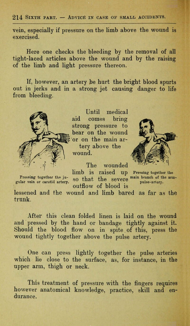 vein, especially if pressure on the limb above the wound is exercised. Here one checks the bleeding by the removal of all tight-laced articles above the wound and by the raising of the limb and light pressure thereon. If, however, an artery be hurt the bright blood spurts out in jerks and in a strong jet causing danger to life from bleeding. Until medical aid comes bring strong pressure to bear on the wound or on the main ar- tery above the wound. The wounded limb is raised Up Pressing together the Pressing together the ju- fhof +Vio aovoro main branch of the «m- gular vein or carotid artery. u 'UcU ~T , . , . pulse-arlery. outflow of blood is lessened and the wound and limb bared as far as the trunk. After this clean folded linen is laid on the wound and pressed by the hand or bandage tightly against it. Should the blood flow on in spite of this, press the wound tightly together above the pulse artery. One can press lightly together the pulse arteries which lie close to the surface, as, for instance, in the upper arm, thigh or neck. This treatment of pressure with the fingers requires however anatomical knowledge, practice, skill and en- durance.