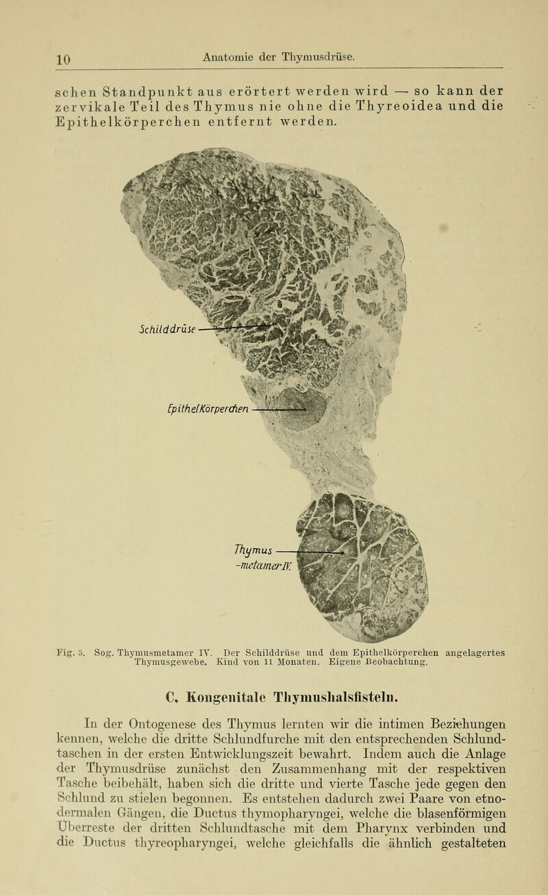 sehen Standpunkt aus erörtert werden wird — so kann der zervikale Teil des Thymus nie ohne die Thyreoidea und die Epithelkörperchen entfernt werden. Schilddrüse [pithelKörperdien Thymus -mtamerJE Fig. :i. Sog. Thymusmetamer IV. Der Schilddrüse und dem Epithelkörperchen angelagertes Thymusgewebe. Kind von 11 Monaten. Eigene Beobachtung. C, Kongenitale Thymushalsfistelii. In der Ontogenese des Thymus lernten wir die intimen Beziehungen kennen, welche die dritte Schlundfurche mit den entsprechenden Schlund- taschen in der ersten Entwicklungszeit bewahrt. Indem auch die Anlage der Thymusdrüse zunächst den Zusammenhang mit der respektiven Tasche beibehält, haben sich die dritte und vierte Tasche jede gegen den Schlund zu stielen begonnen. Es entstehen dadurch zwei Paare von etno- dermalen Gängen, die Ductus thymopharyngei, welche die blasenförmigen Überreste der dritten Schlundtasche mit dem Pharynx verbinden und die Ductus thyreopharyngei, welche gleichfalls die ähnlich gestalteten