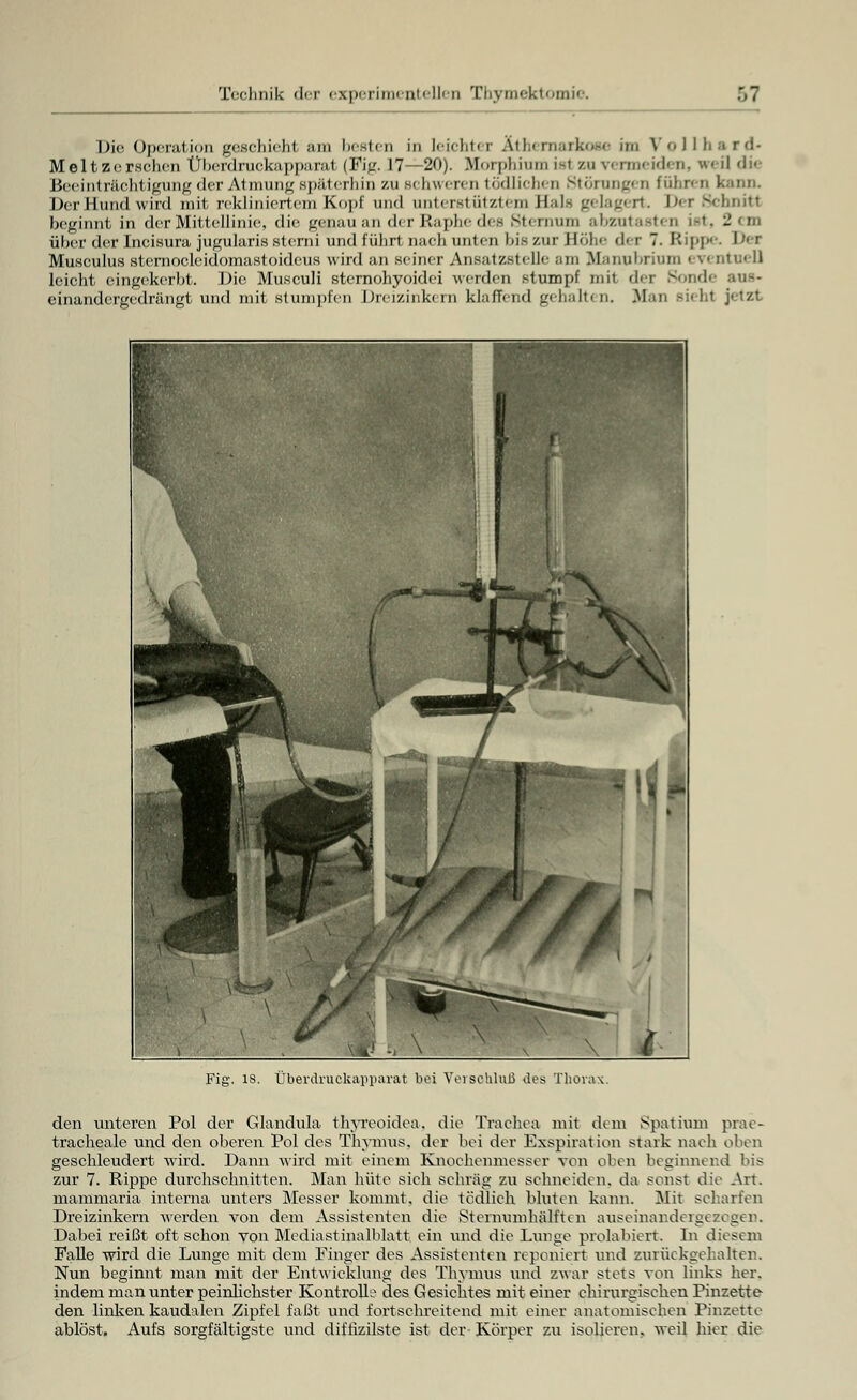 Die Operation geschieht am besten in leichter Äthernarkoae im V o 1 11 Meltzcrsclicn Überdruckapparal (Kg. 17—20). Morphium iel zu \> rmeiden, ireü die Beeinträchtigung der Atmung späterhin zu schweren tödlichen Störungen fuhren kann. Der-Hund wird mit rekliniertem Kopf und unterstütztem Eah gelagert Der Schnitt beginnt in der Mittellinie, die gejaau an der Raphe des Bternum abzutasten ist, 2 cm über der Incisura jugularis st emi und führt nach unten bis zur Höhe der 7. Etipp I i Musculus sternoclcidomastoideus wird an seiner Ansatzstelle am Manubrium 6V( nti:- II leicht eingekerbt. Die Musculi sternohyoidei werden stumpf mit der Sonde aus- einandergedrängt und mit stumpfen Dreizinkem klaffend gehalten. Man siehl jetzt Fig. is. Überdruckapparat bei Vei Schluß des Thorax. den unteren Pol der Glandula thyreoidea. die Trachea mit dem Spatium prae- tracheale und den oberen Pol des Thymus, der bei der Exspiration stark nach oben geschleudert wird. Dann wird mit einem Knochenmesser von ölen beginnend bis zur 7. Rippe durchschnitten. Man hüte sich schräg zu schneiden, da sonst die Art. mammaria interna unters Messer kommt, die tödlich bluten kann. Mit scharfen Dreizinkem werden von denn Assistenten die Stenmmhälften auseinandergezogen. Dabei reißt oft schon von Mediastinalblatt ein und die Lunge prolabiert. In diesem Falle wird die Lunge mit dem Finger des Assistenten reponiert und zurückgehalten. Nun beginnt man mit der Entwicklung des Thymus und zwar stets von links her. indem man unter peinlichster Kontrolle des Gesichtes mit einer chirurgischen Pinzette den linken kaudalen Zipfel faßt und fortschreitend mit einer anatomischen Pinzette ablöst. Aufs sorgfältigste und diffizilste ist der Körper zu isolieren, weil hier die