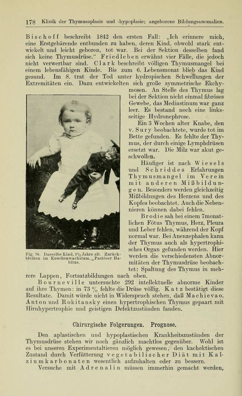 B i s c h o f f beschreibt 1842 den ersten Fall: „Ich erinnere mich, eine Erstgebärende entbunden zu haben, deren Kind, obwohl stark ent- wickelt und leicht geboren, tot war. Bei der Sektion desselben fand sich keine Thymusdrüse. Friedleben erwähnt vier Fälle, die jedoch nicht verwertbar sind. Clark beschreibt völligen Thymusmangel bei einem lebensfähigen Kinde. Bis zum 6. Lebensmonat blieb das Kind gesund. Im 8. trat der Tod unter hydropischen Schwellungen der Extremitäten ein. Dazu entwickelten sich große symmetrische Ekchy- mosen. An Stelle des Thymus lag bei der Sektion nicht einmal fibröses Gewebe, das Mediastinum war ganz leer. Es bestand noch eine links- seitige Hydronephrose. Ein 3 Wochen alter Knabe, den v. Sury beobachtete, wurde tot im Bette gefunden. Es fehlte der Thy- mus, der durch einige Lymphdrüsen ersetzt war. Die Milz war akut ge- schwollen. Häufiger ist nach Wiesels und Schriddes Erfahrungen Thymusmangel im Verein mit anderen Mißbildun- gen. Besonders werden gleichzeitig Mißbildungen des Herzens und des Kopfes beobachtet. Auch die Neben- nieren können dabei fehlen. B r o d i e sah bei einem 7monat- lichen Fötus Thymus, Herz, Pleura und Leber fehlen, während der Kopf normal war. Bei Anenzephalen kann der Thymus auch als hypertrophi- sches Organ gefunden werden. Hier werden die verschiedensten Abnor- mitäten der Thymusdrüse beobach- tet: Spaltung des Thymus in meh- rere Lappen, Fortsatzbildungen nach oben. Bourneville untersuchte 292 intellektuelle abnorme Kinder auf ihre Thymen: in 73 % fehlte die Drüse völlig. K a t z bestätigt diese Resultate. Damit würde nicht in Widerspruch stehen, daß Machievao, Anton und Rokitansky einen hypertrophischen Thymus gepaart mit Hirnhypertrophie und geistigen Defektzuständen fanden. Fig. 76. Dasselbe Kind, 21/2 Jahre alt. Zurück- bleiben im Knochenwaclistum.^Pastöser Ha- bitus. Chirurgische Folgerungen. Prognose. Den aplastischen und hypoplastischen Krankheitszuständen der Thymusdrüse stehen wir noch gänzlich machtlos gegenüber. Wohl ist es bei unseren Experimentaltieren möglich gewesen, den kachektischen Zustand durch Verfütterung vegetabilischer Diät mit Kal- ziumkarbonaten wesentlich aufzuhalten oder zu bessern. Versuche mit Adrenalin müssen immerhin gemacht werden,