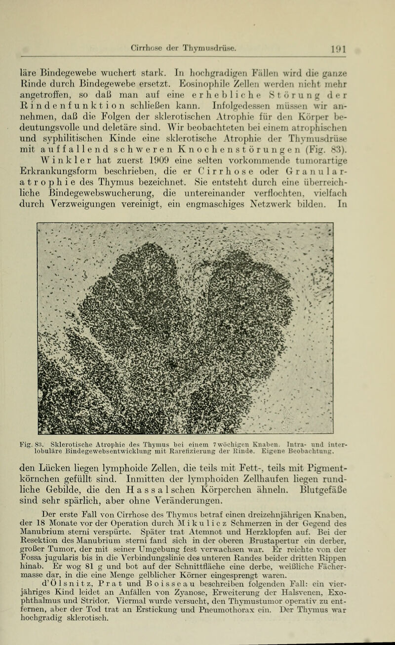 läre Bindegewebe wuchert stark. In hochgradigen I*';illen wird die ganze Rinde durch Bindegewebe ersetzt. Eosinophile Zellen werden nichl tnehi angetroffen, so daß man auf eine erhebliche St ö r u n g d <• r Rindenfunktion schließen kann. Infolgedessen müssen wir an- nehmen, daß die Folgen der sklerotischen Atrophie für den Körper be- deutungsvolle und deletäre sind. Wir bec)bachteten Lei einem atrophischen und syphilitischen Kinde eine sklerotische Atrophie der Thymusdrüse mit auffallend schweren Knochen Störungen (l'i_r. <> i. Wink ler hat zuerst 1909 eine selten vorkommende tumorartige Erkrankungsform beschrieben, die er Cirrhose oder Granulär- a t r o p h i e des Thymus bezeichnet. Sie entsteht durch eine überreich- liche Bindegewebs Wucherung, die untereinander verflochten, vielfach durch Verzweigungen vereinigt, ein engmaschiges Netzwerk bilden. In .'; .,'•' ' - -'■ *' V ' - - ,*.%-'*•* .. ' - - - «. - • >.'- ' * •- »- • '.•'•-' 7 ' 4*. -'. *-/''-i;V ■-',.- .'-'- > ■  * * * S ' * 'ji^SS  ■'-■■■' ^ -^ilill  • -'•'•'1 /„j^^^ps !BPiRHBPIl< '*' * ■ • _' HBhHHr''; ' '• . ': ^^^^^^^^^^^^^^^ • • i ^mWcffl^w§ß^&' - mmmm'':-' Fig. 83. Sklerotische Atrophie des Thymus bei einem 7wöchigen Knaben. Intra- und inter- lobuläre Bindegewebsentwieklung'mit Rarefizierung der Kinde. Eigene Beobachtung. den Lücken liegen lymphoide Zellen, die teils mit Fett-, teils mit Pigment- körnchen gefüllt sind. Inmitten der lvmphoiden Zellhaufen liegen rund- liche Gebilde, die den H a s s a 1 sehen Körperchen ähneln. Blutgefäße sind sehr spärlich, aber ohne Veränderungen. Der erste Fall von Cirrhose des Thymus betraf einen dreizehnjährigen Knaben, der 18 Monate vor der Operation durch Mikulicz Schmerzen in der Gegend des Manubrium sterni verspürte. Später trat Atemnot und Herzklopfen auf. Bei der Resektion des Manubrium sterni fand sich in der oberen Brustapertur ein derber, großer Tumor, der mit seiner Umgebung fest verwachsen Mar. Er reichte von der Fossa jugularis bis in die Verbindungslinie des unteren Randes beider dritten Rippen hinab. Er wog 81 g und bot auf der Schnittfläche eine derbe, weißliche Fächer- masse dar, in die eine Menge gelblicher Körner eingesprengt waren. d'Ö 1 s n i t z, P r a t und Boisseau beschreiben folgenden Fall: ein vier- jähriges Kind leidet an Anfällen von Zyanose, Erweiterung der Halsvenen, Exo- phthalmus und Stridor. Viermal wurde versucht, den Thyruustumor operativ zu ent- fernen, aber der Tod trat an Erstickung und Pneumothorax ein. Der Thymus war hochgradig sklerotisch.