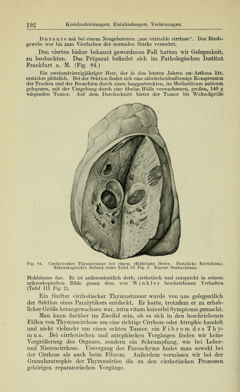 D u r a n t e sah bei einem Neugeborenen „une veritable cirrhose. Das Binde- gewebe war bis zum Vierfachen der normalen Stärke vermehrt. Den vierten bisher bekannt gewordenen Fall hatten wir Gelegenheit, zu beobachten. Das Präparat befindet sich im Pathologischen Institut Frankfurt a. M. (Fig. 84.) Ein zweiund vierzig jähriger Herr, der in den letzten Jahren an Asthma litt, erstickte plötzlich. Bei der Sektion findet sich eine säbelscheidenförmige Kompression der Trachea und der Bronchien durch einen langgestreckten, im Mediastinum anticum gelegenen, mit der Umgebung durch eine fibröse Hülle verwachsenen, großen, 140 g wiegenden Tumor. Auf dem Durchschnitt bietet der Tumor bis Walnußgröße xs A Fig. 84. Cirrhotischer Thymustumor bei einem 42jährigen Herrn. Plötzliche Erstickung Mikroskopischer Befund siehe Tafel III Fig. 2. Eigene Beobachtung. Hohlräume dar. Er ist außerordentlich derb, cirrhotisch und entspricht in seinem mikroskopischen Bilde genau dem von W i n k 1 e r beschriebenen Verhalten (Tafel III Fig. 2). Ein fünfter cirrhotischer Thymustumor wurde von uns gelegentlich der Sektion eines Paralytikers entdeckt. Er hatte, trotzdem er zu erheb- licher Größe herangewachsen war, intra vitam keinerlei Symptome gemacht. Man kann darüber im Zweifel sein, ob es sich in den beschriebenen Fällen von Thymuscirrhose um eine richtige Cirrhose oder Atrophie handelt und nicht vielmehr um einen echten Tumor, ein Fibrom des Thy- mus. Bei cirrhotischen und atrophischen Vorgängen linden wir keine Vergrößerung des Organes, sondern ein Schrumpfung, wie bei Leber- und Nierencirrhose. Untergang des Parenchyms findet man sowohl bei der Cirrhose als auch beim Fibrom. Außerdem vermissen wir bei der Granularatrophie der Thymusdrüse die zu den cirrhotischen Prozessen gehörigen reparatorischen Vorgänge.