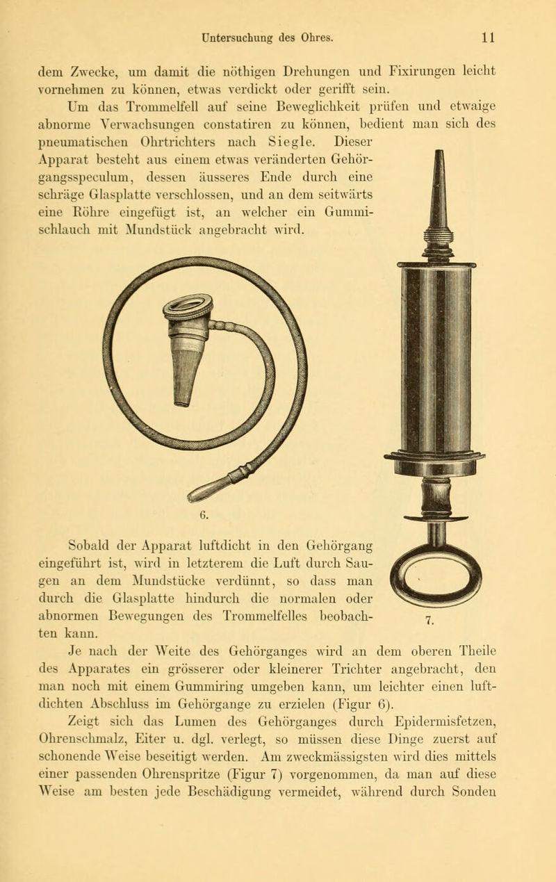 dem Zwecke, um damit die nöthigen Drehungen und Fixirungen leicht vornehmen zu können, etwas verdickt oder gerifft sein. Um das Trommelfell auf seine Beweglichkeit prüfen und etwaige abnorme Verwachsungen eonstatiren zu können, bedient man sich des pneumatischen Ohrtrichters nach Siegle. Dieser Apparat besteht aus einem etwas veränderten Gehör- gangsspeculum, dessen äusseres Ende durch eine schräge (ilasplatte verschlossen, und an dem seitwärts eine Röhre eingefügt ist, an welcher ein Gummi- schlauch mit Mundstück angebracht wird. Sobald der Apparat luftdicht in den Gehörgang eingeführt ist, wird in letzterem die Luft durch Sau- gen an dem Mundstücke verdünnt, so dass man durch die Glasplatte hindurch die normalen oder abnormen Bewegungen des Trommelfelles beobach- 7 ten kann. Je nach der Weite des Gehörganges wird an dem oberen Theile des Apparates ein grösserer oder kleinerer Trichter angebracht, den man noch mit einem Gummiring umgeben kann, um leichter einen luft- dichten Abschluss im Gehörgange zu erzielen (Figur 6). Zeigt sich das Lumen des Gehörganges durch Epidermisfetzen, Ohrenschmalz, Eiter u. dgl. verlegt, so müssen diese Dinge zuerst auf schonende Ureise beseitigt werden. Am zweckmässigsten wird dies mittels einer passenden Ohrenspritze (Figur 7) vorgenommen, da man auf diese Weise am besten jede Beschädigung vermeidet, während durch Sonden