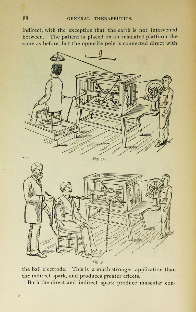 indirect, with the exception that the earth is not intervened between. The patient is placed on an insulated platform the same as before, but the opposite pole is connected direct with ■—8-—^ Fig. 51 the ball electrode. This is a much stronger application than the indirect spark, and produces greater effects. Both the direct and indirect spark produce muscular con-