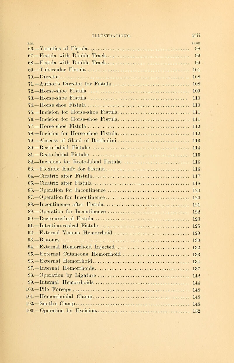 FIG. PAGE 66.—Varieties of Fistula. 98 67— Fistula with Double Track 99 68.—Fistula with Double Track 99 69.—Tubercular Fistula 101 70.—Director 108 71.—Author's Director for- Fistula 108 72.—Horse-shoe Fistula 109 73.—Horse-shoe Fistula 110 74.—Horse-shoe Fistula 110 75.—Incision for Horse-shoe Fistula Ill 76.—Incision for Horse-shoe Fistula Ill 77.—Horse-shoe Fistula 112 78.—Incision for Horse-shoe Fistula 112 79.—Abscess of Gland of Bartholini 113 80.— Recto-labial Fistulse 114 81.—Recto-labial Fistula; 115 82.—Incisions for Kecto-labial Fistulae 116 83.—Flexible Knife for Fistula 116 84.—Cicatrix after Fistula 117 85.—Cicatrix after Fistula 118 86.—Operation for Incontinence 120 87.—Operation for Incontinence 120 88.—Incontinence after Fistula 121 89.—Operation for Incontinence 122 90.—Recto-urethral Fistula 123 91.—Intestino-vesical Fistula 125 92.—External Venous Hemorrhoid . 129 93.—Bistoury 130 94.—External Hemorrhoid Injected 132 95.—External Cutaneous Hemorrhoid 133 96.—External Hemorrhoid 134 97.—Internal Hemorrhoids 137 98.—Operation by Ligature 142 99.—Internal Hemorrhoids 144 100.—Pile Forceps 148 101.—Hemorrhoidal Clamp 148 102.—Smith's Clamp 148 103.—Operation by Excision 152