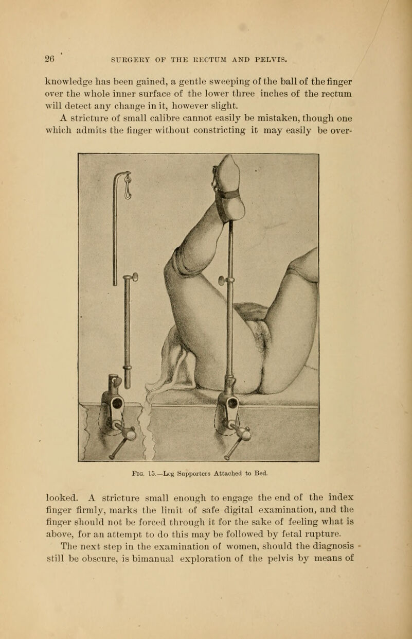 knowledge has been gained, a gentle sweeping of the ball of the finger over the whole inner surface of the lower three inches of the rectum will detect any change in it, however slight. A stricture of small calibre cannot easily be mistaken, though one which admits the finger without constricting it may easily be over- Fia. 15.—Leg Supporters Attached to Bed. looked. A stricture small enough to engage the end of the index finger firmly, marks the limit of safe digital examination, and the finger should not be forced through it for the sake of feeling what is above, for an attempt to do this may be followed by fetal rupture. The next step in the examination of women, should the diagnosis still be obscure, is bimanual exploration of the pelvis by means of