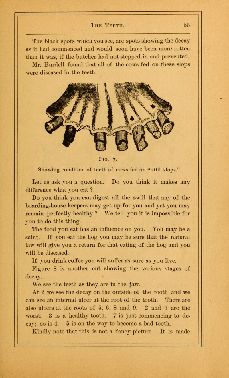 The black spots which you see, are spots showing the decay as it had commenced and would soon have been more rotten than it was, if the butcher had not stepped in and prevented. Mr. Burdell found that all of the cows fed on these slops were diseased in the teeth. Fig. 7. Showing condition of teeth of cows fed on  still slops. Let us ask you a question. Do 3-011 think it makes an}r difference what you eat ? Do you think 3011 can digest all the swill that any of the boarding-house keepers may get up for 3-ou and yet 3-011 ma}- remain perfect^- healthy ? We tell you it is impossible for 3-ou to do this thing. The food you eat has an influence on 3-011. You may be a saint. If 3'ou eat the hog you ma3' be sure that the natural law will give 3-011 a return for that eating of the hog and you will be diseased. If 3-011 drink coffee 3'ou will suffer as sure as 3-011 live. Figure 8 is another cut showing the various stages of deca3r. We see the teeth as the3T are in the jaw. At 2 we see the deca3' on the outside of the tooth and we can see an internal ulcer at the root of the tooth. There are also ulcers at the roots of 5, 6, 8 and 9. 2 and 9 are the worst. 3 is a healtlry tooth. 7 is just commencing to de- ca3-; so is 4. 5 is on the wa3T to become a bad tooth. Kindly note that this is not a fancy picture. It is made