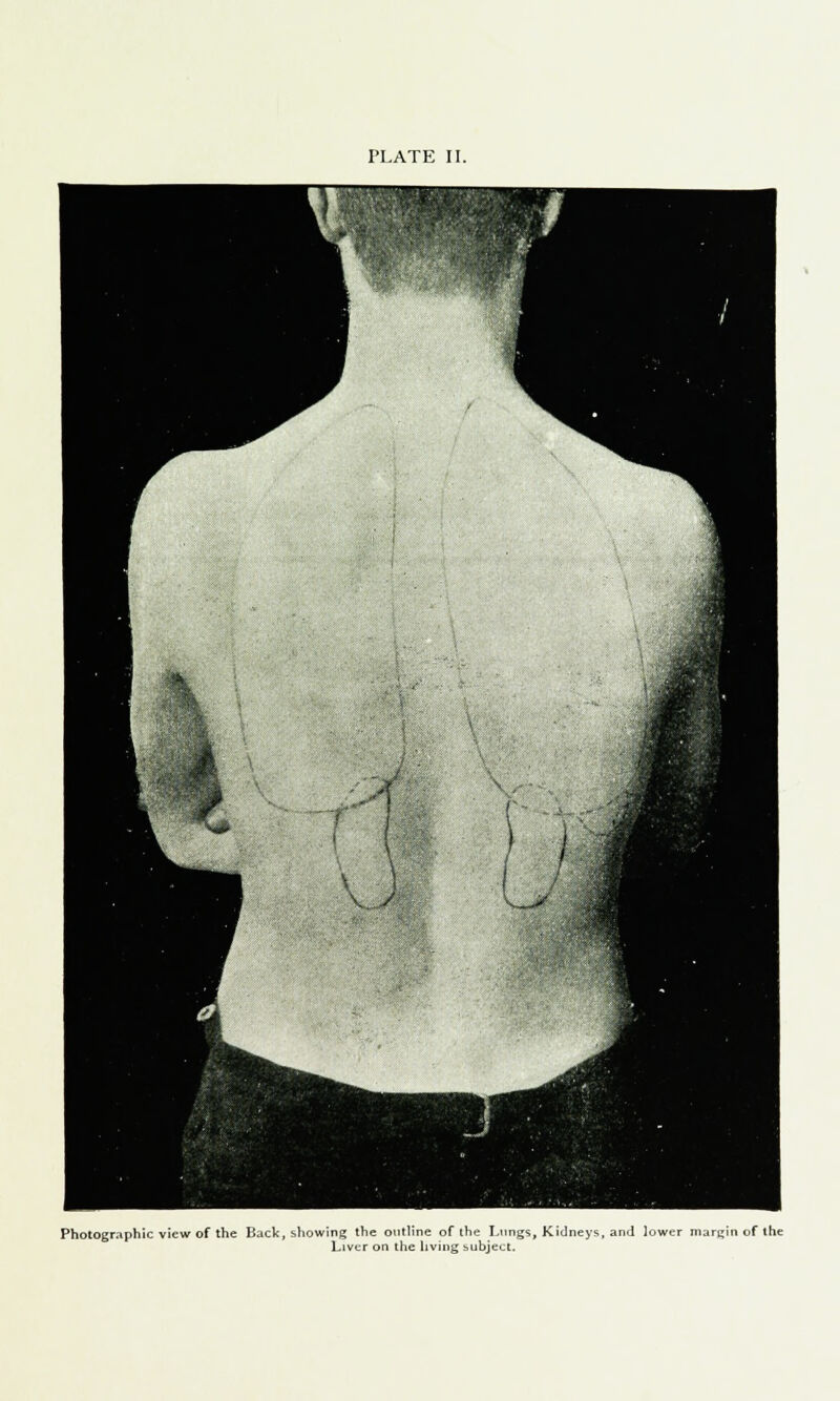 Photographic view of the Back, showing the outline of the Lungs, Kidneys, and lower margin of the Liver on the living subject.