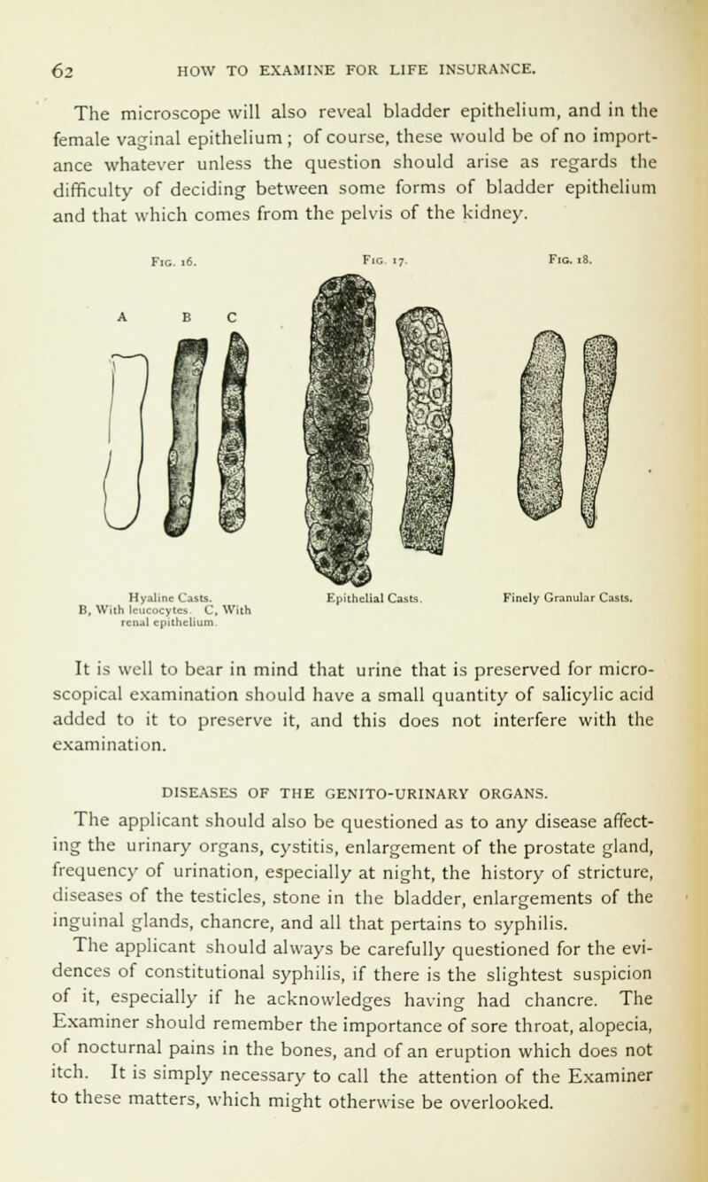 The microscope will also reveal bladder epithelium, and in the female vaginal epithelium ; of course, these would be of no import- ance whatever unless the question should arise as regards the difficulty of deciding between some forms of bladder epithelium and that which comes from the pelvis of the kidney. Fig. 16. B C Hyaline Casts. B, With leucocytes C. With renal epithelium Epithelial Casts. Finely Granular Casts. It is well to bear in mind that urine that is preserved for micro- scopical examination should have a small quantity of salicylic acid added to it to preserve it, and this does not interfere with the examination. DISEASES OF THE GENITO-URINARY ORGANS. The applicant should also be questioned as to any disease affect- ing the urinary organs, cystitis, enlargement of the prostate gland, frequency of urination, especially at night, the history of stricture, diseases of the testicles, stone in the bladder, enlargements of the inguinal glands, chancre, and all that pertains to syphilis. The applicant should always be carefully questioned for the evi- dences of constitutional syphilis, if there is the slightest suspicion of it, especially if he acknowledges having had chancre. The Examiner should remember the importance of sore throat, alopecia, of nocturnal pains in the bones, and of an eruption which does not itch. It is simply necessary to call the attention of the Examiner to these matters, which might otherwise be overlooked.