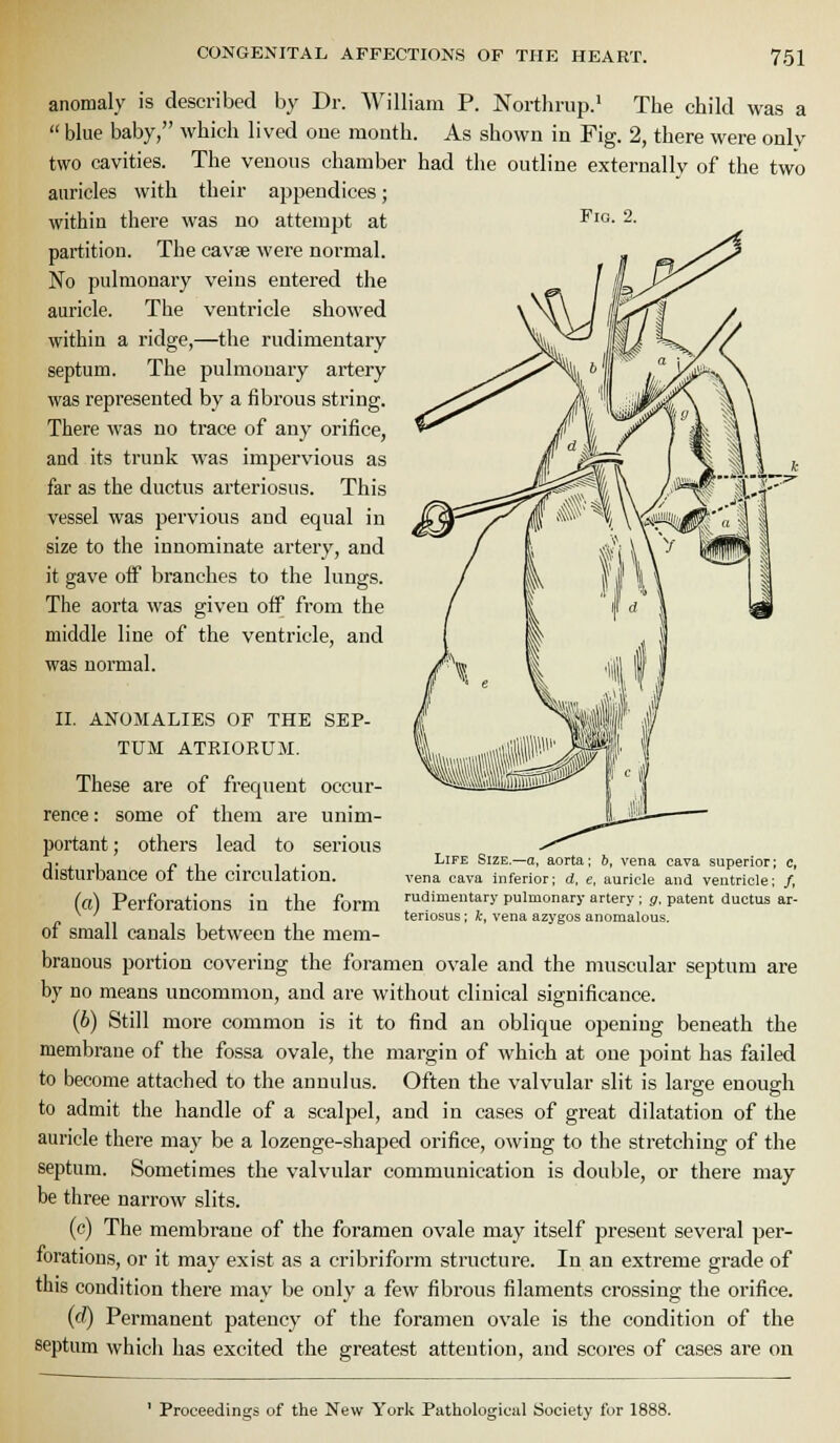 Fig. anomaly is described by Dr. William P. Northrup.' The child was a  blue baby, which lived one mouth. As shown in Fig. 2, there were only two cavities. The venous chamber had the outline externally of the two auricles with their appendices; within there was no attempt at partition. The cavse were normal. No pulmonary veins entered the auricle. The ventricle showed within a ridge,—the rudimentary septum. The pulmonary artery was represented by a fibrous string. There was no trace of any orifice, and its trunk was impervious as far as the ductus arteriosus. This vessel was pervious and equal in size to the innominate artery, and it gave off branches to the lungs. The aorta was given off from the middle line of the ventricle, and was normal. II. ANOMALIES OF THE SEP- TUM ATEIORUM. These are of frequent occur- rence : some of them are unim- portant; others lead to serious disturbance of the circulation. (a) Perforations in the form of small canals between the mem- LiFE Size.—a, aorta; b, vena cava superior; c, vena cava inferior; d, e, auricle and ventricle; /, rudimentary pulmonary artery ; g, patent ductus ar- teriosus ; k, vena azygos anomalous. branous portion covering the foramen ovale and the muscular septum are by no means uncommon, and are without clinical significance. (6) Still more common is it to find an oblique opening beneath the membrane of the fossa ovale, the margin of which at one point has failed to become attached to the annul us. Often the valvular slit is large enough to admit the handle of a scalpel, and in cases of great dilatation of the auricle there may be a lozenge-shaped orifice, owing to the stretching of the septum. Sometimes the valvular communication is double, or there may be three narrow slits. (c) The membrane of the foramen ovale may itself present several per- forations, or it may exist as a cribriform structure. In an extreme grade of this condition there may be only a few fibrous filaments crossing the orifice. (rf) Permanent patency of the foramen ovale is the condition of the septum which has excited the greatest attention, and scores of cases are on ' Proceedings of the New York Pathological Society for 1888.