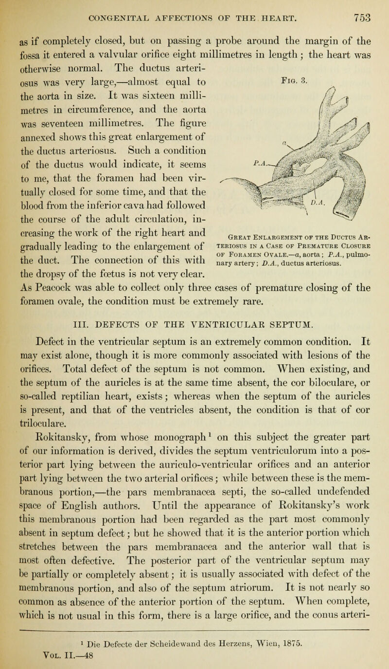 as if completely closed, but on passing a probe around the margin of the fossa it entered a valvular orifice eight millimetres in length; the heart was otherwise normal. The ductus arteri- osus was very large,—almost equal to the aorta in size. It was sixteen milli- metres in circumference, and the aorta was seventeen millimetres. The figure annexed shows this great enlargement of the ductus arteriosus. Such a condition of the ductus would indicate, it seems to me, that the foramen had been vir- tually closed for some time, and that the blood from the inferior cava had followed the course of the adult circulation, in- creasing the work of the right heart and gradually leading to the enlargement of the duct. The connection of this with the dropsy of the foetus is not very clear. As Peacock was able to collect only three cases of premature closing of the foramen ovale, the condition must be extremely rare. Great Enlargement of the Ductus Ar- teriosus IN A Case of Premature Closure OF Foramen Ovale.—a, aorta; P.^., pulmo- nary artery; D. J., ductus arteriosus. III. DEFECTS OF THE VENTRICULAR SEPTUM. Defect in the ventricular septum is an extremely common condition. It may exist alone, though it is more commonly associated with lesions of the orifices. Total defect of the septum is not common. When existing, and the septum of the auricles is at the same time absent, the cor biloculare, or so-called reptilian heart, exists; whereas when the septum of the auricles is present, and that of the ventricles absent, the condition is that of cor triloculare. Rokitansky, from whose monograph' on this subject the greater part of our information is derived, divides the septum ventriculorum into a pos- terior part lying between the auriculo-ventricular orifices and an anterior part lying between the two arterial orifices; while between these is the mem- branous portion,—the pars membranacea septi, the so-called undefended space of English authors. Until the appearance of Rokitausky's work this membranous portion had been regarded as the part most commonly absent in septum defect; but he showed that it is the anterior portion which stretches between the pars membranacea and the anterior wall that is most ofl;en defective. The posterior part of the ventricular septum may i)e partially or completely absent; it is usually associated with defect of the membranous portion, and also of the septum atriorum. It is not nearly so common as absence of the anterior portion of the septum. When complete, which is not usual in this form, there is a large orifice, and the conns arteri- ' Die Defects der Scheidewand des Herzens, Wieu, 187.5. Vol. II.—48